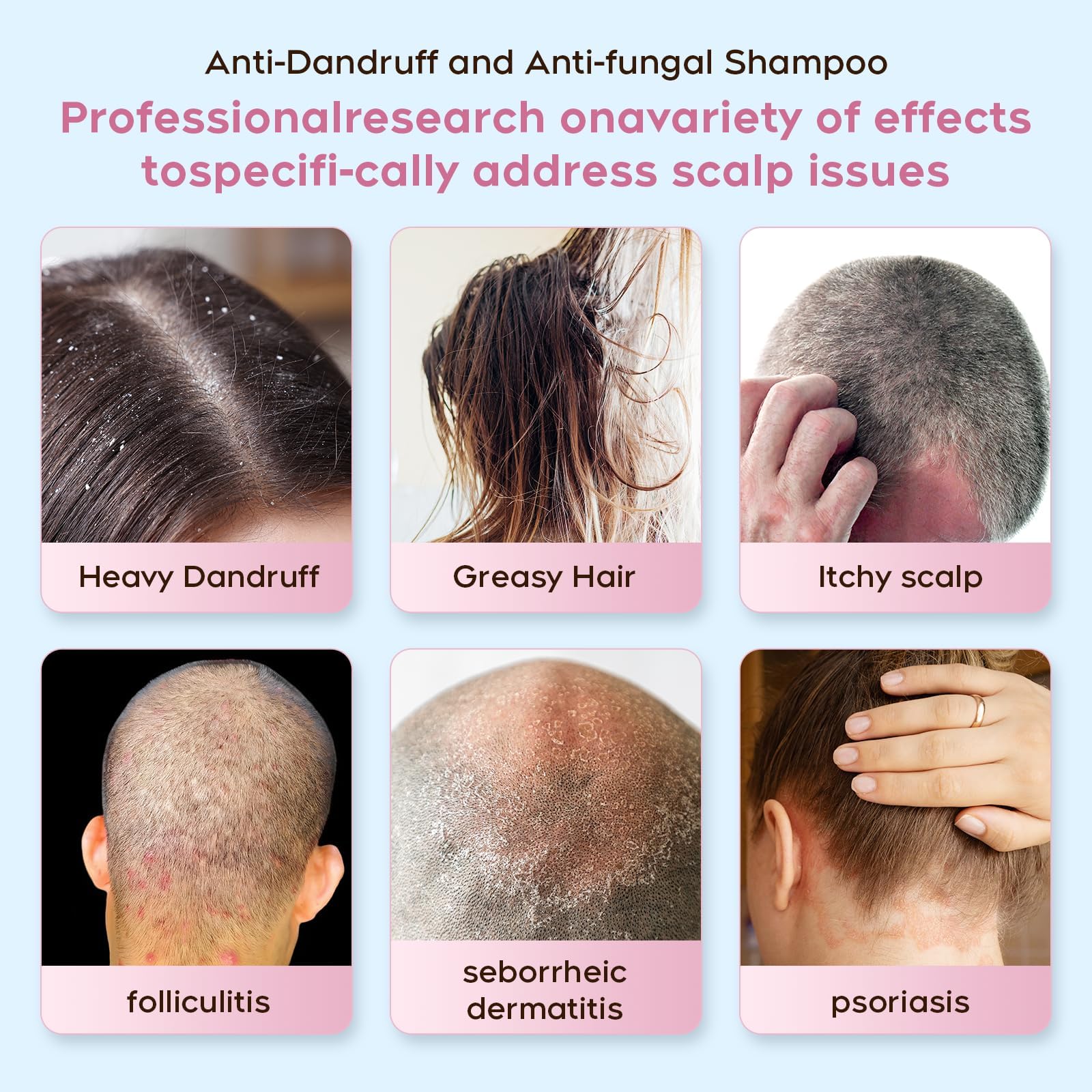 Anti fungal Shampoo for Psoriasis, Seborrheic Dermatitis & Folliculitis - Physician-Formulated Relieves Itchy, Dry Scalp - Sulfate & Paraben Free Anti-Dandruff Shampoo for Men and Women,8.4 fl oz.