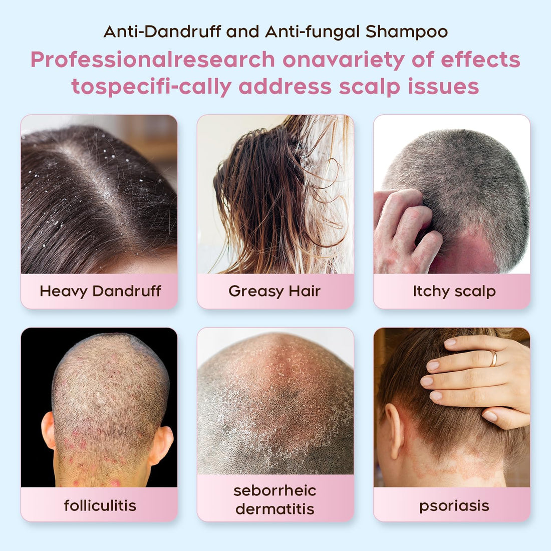 Anti fungal Shampoo for Psoriasis, Seborrheic Dermatitis & Folliculitis - Physician-Formulated Relieves Itchy, Dry Scalp - Sulfate & Paraben Free Anti-Dandruff Shampoo for Men and Women,8.4 fl oz.