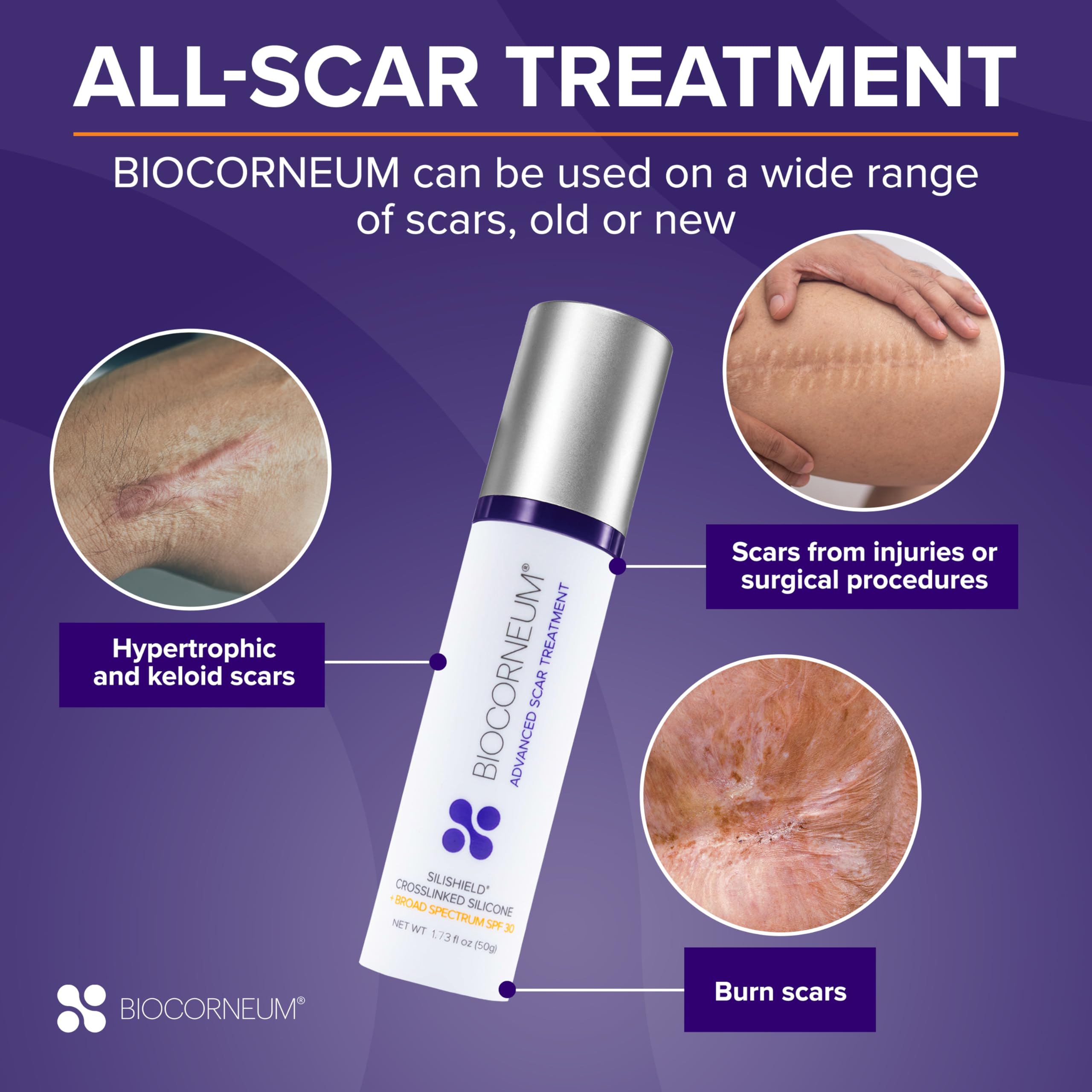 Advanced Scar Treatment with Silishield® & SPF 30 20g – Made in the USA, Fast-Drying, Water-Resistant Silicone Scar Gel - Surgeon Recommended for New & Old Scars - Suitable for Children Over 6 Months