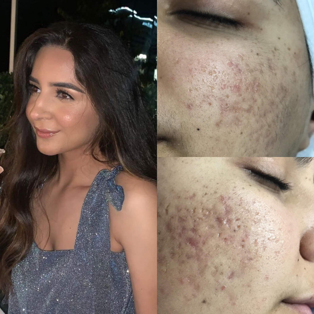 MT Skin Clinic Pro Advanced Hyaluronic Acid Serum for Face, Glow+ Antioxidant Protein-Rich Face Lift Serum with Vitamin C, Niacinamide and B5 for Dry Skin Hydrating and Anti-Aging, 2oz