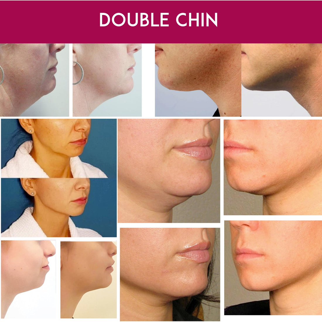 Vela Contour Double Chin Reducer Neck Line Face Lift Slim (Cream Masks Belt)