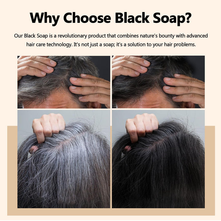 VAEYAE 2 Pcs Herbal Black Soap for Gray Hair Reverse, Fo Ti Castor Oil for Hair Darkening & Thickening, Men & Women Hair Growth Grey Cover Shampoo Bar, Natural Polygonum Multiforum Reducing Hair Loss