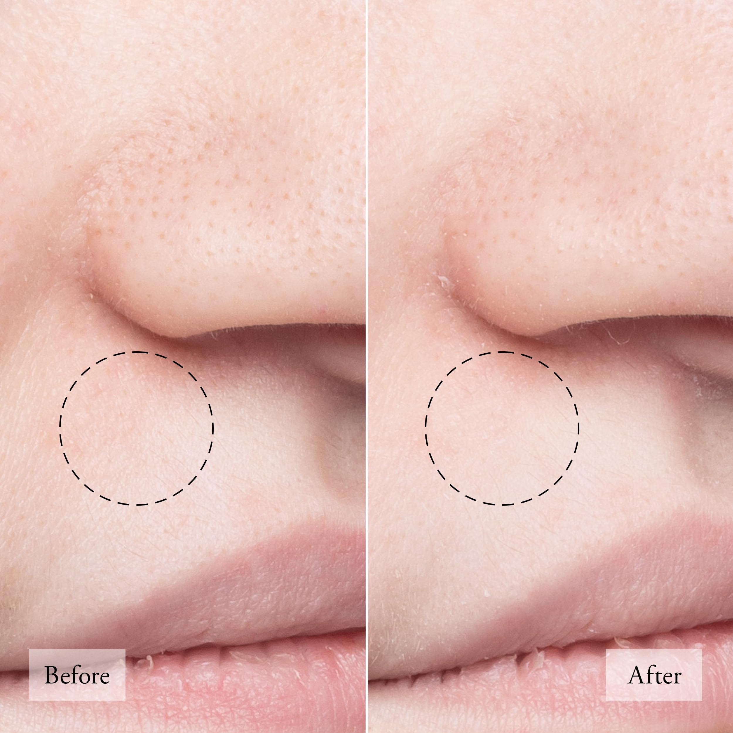 Philosophy Purity Made Simple Pore Extractor Exfoliating Clay Mask, 1 Ounce