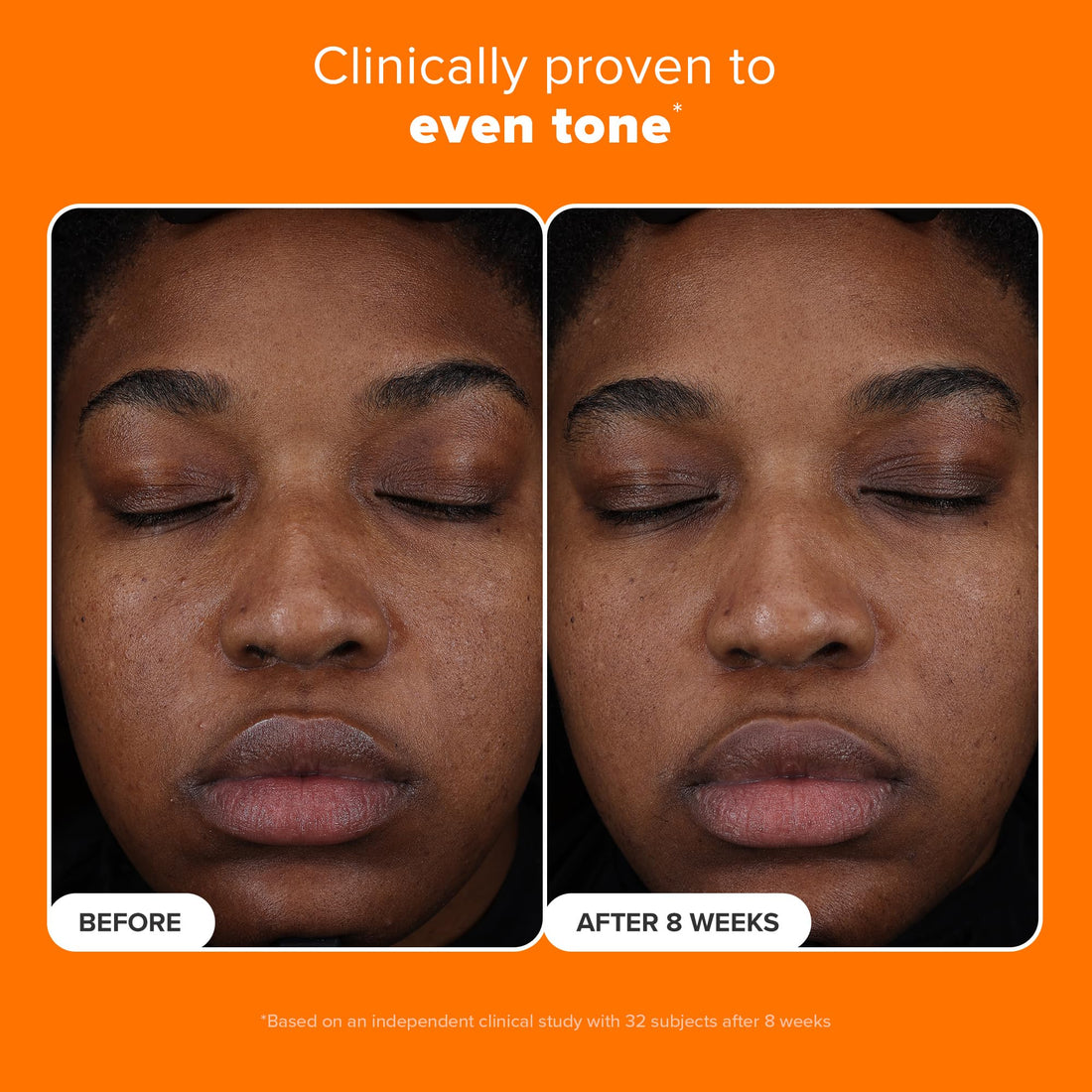 Paula’s Choice 25% Vitamin C Serum with Glutathione & Antioxidants, Improves Discoloration, Uneven Tone & Firms, Fragrance-Free & Paraben-Free, 1 Fl Oz