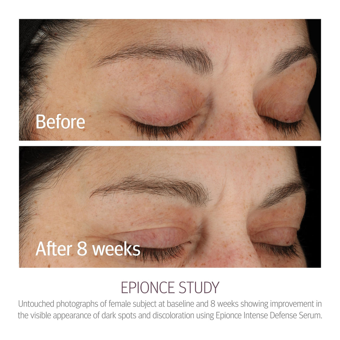 Epionce Intense Defense Serum, 1 Fluid Ounce