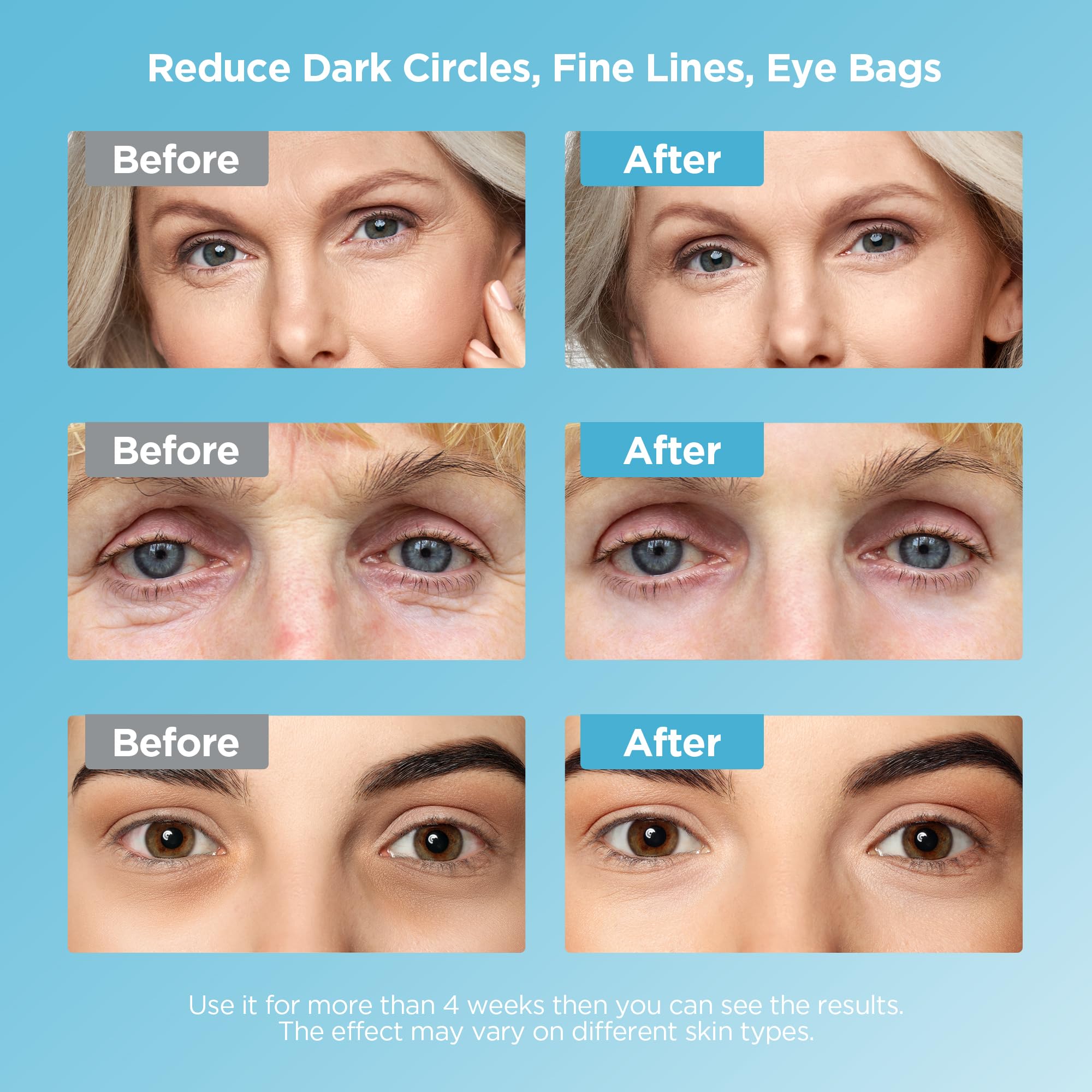 Dongyu Caffeine Eye Cream Set: Eye Serum Kit for Dark Circles Puffiness - Anti Aging Eye Cream Set for Fine Lines Wrinkles Day Night Use - Self Care Gifts for Women Birthday Gifts for Her