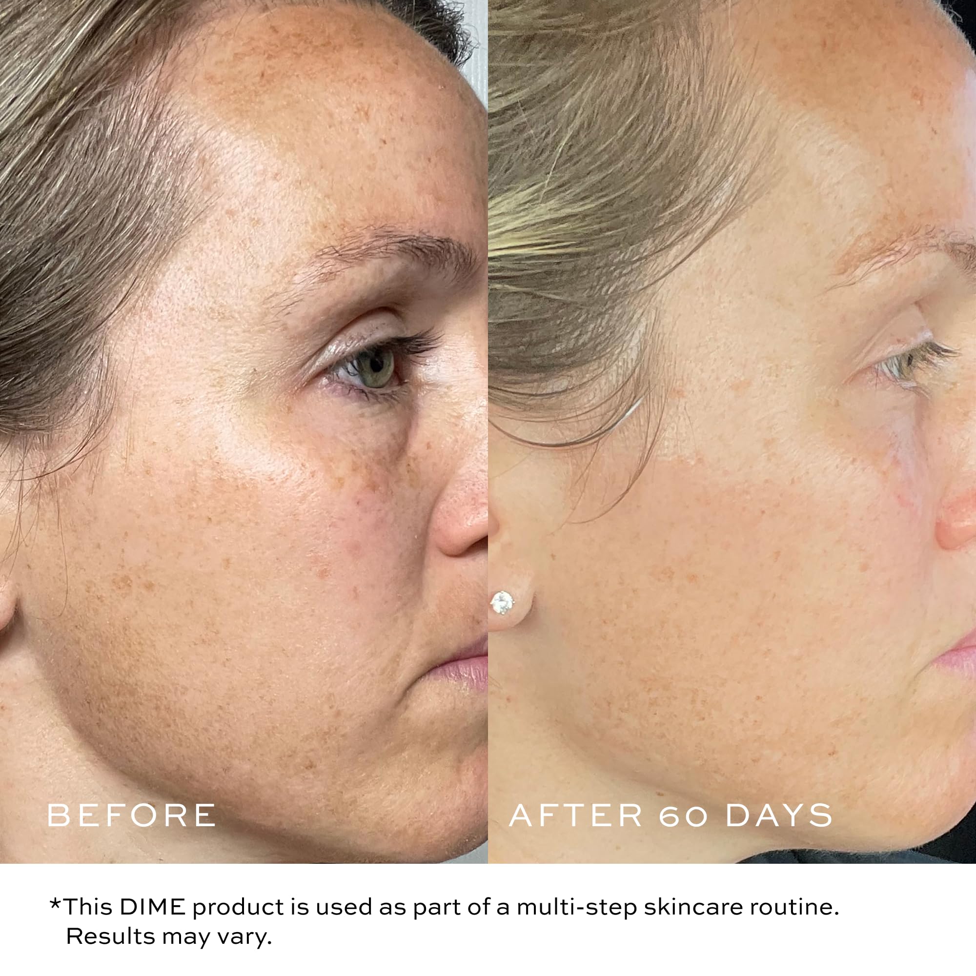 DIME Beauty TBT Reviving Skincare Set ($32 Value) - Includes TBT Cream (15 ml) + Serum (10 ml), Formulated with Bakuchiol, a Clean Retinol Alternative to Reduce the Appearance of Fine Lines & Wrinkles