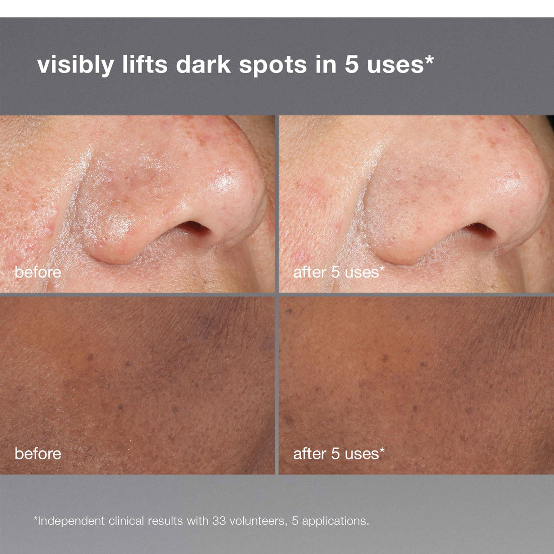 Dermalogica PowerBright Dark Spot Face Peel, Exfoliating Facial Peel with 12% AHA PHA, Improve Dark Spot and Hyperpigmentation for All Skin Types