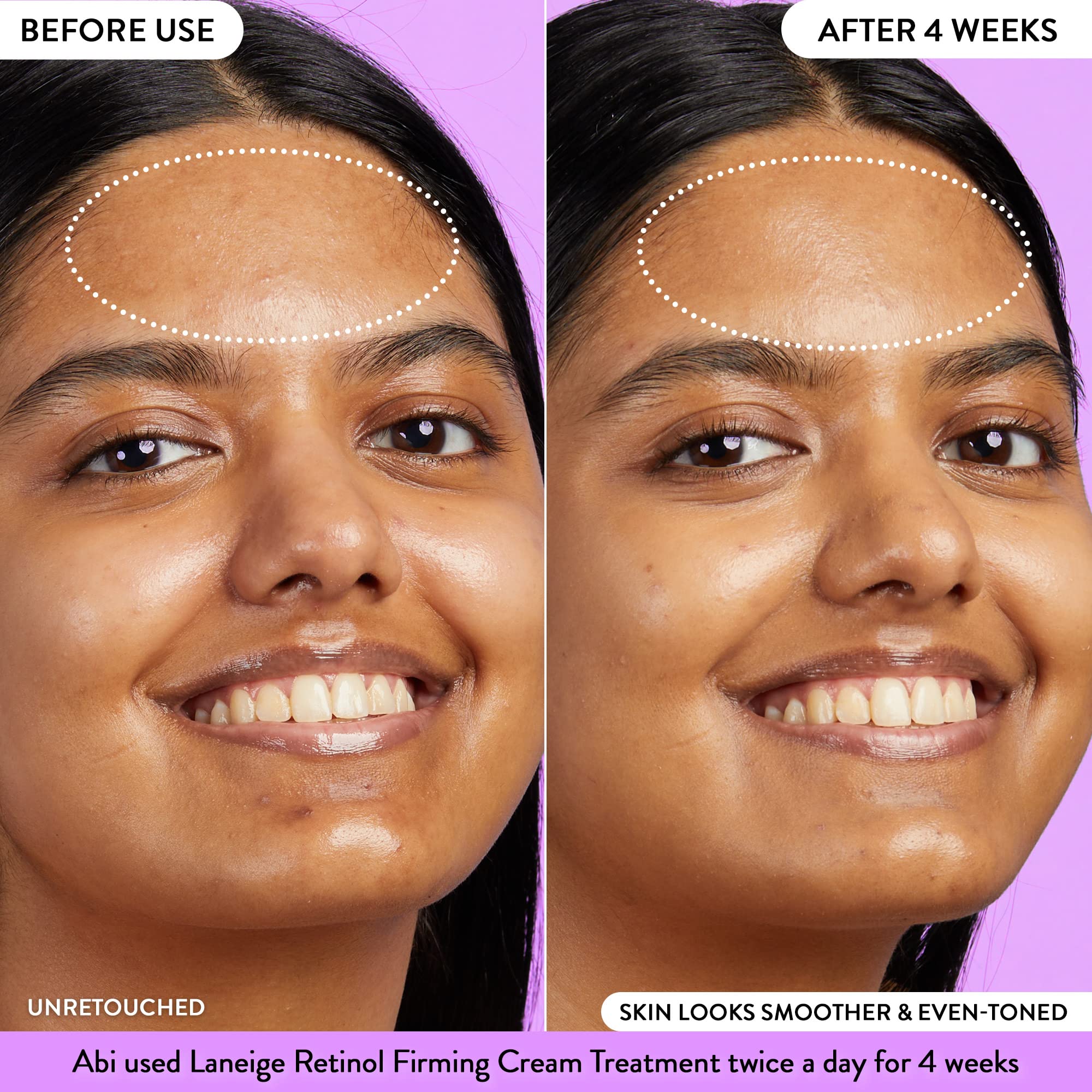 LANEIGE Retinol Firming Cream Treatment: Visibly firm and smooth the look of fine lines and wrinkles.