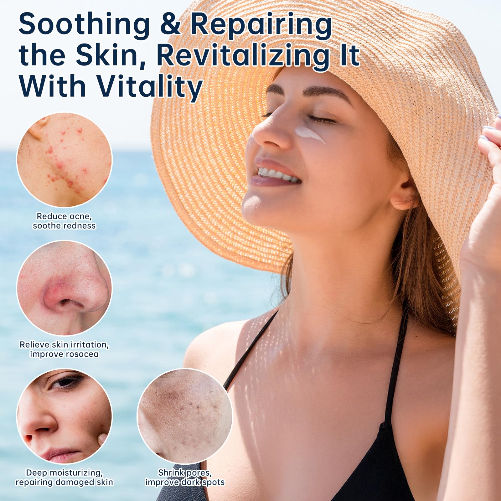 Azelaic Acid 14 Percent Cream For Face, Azelaic Acid Gel For Dark Spot, 30ML Azelaic Acid Acne Cream With Salicylic Acid, Niacinamide & Vitamin C, Relieve Irritation.