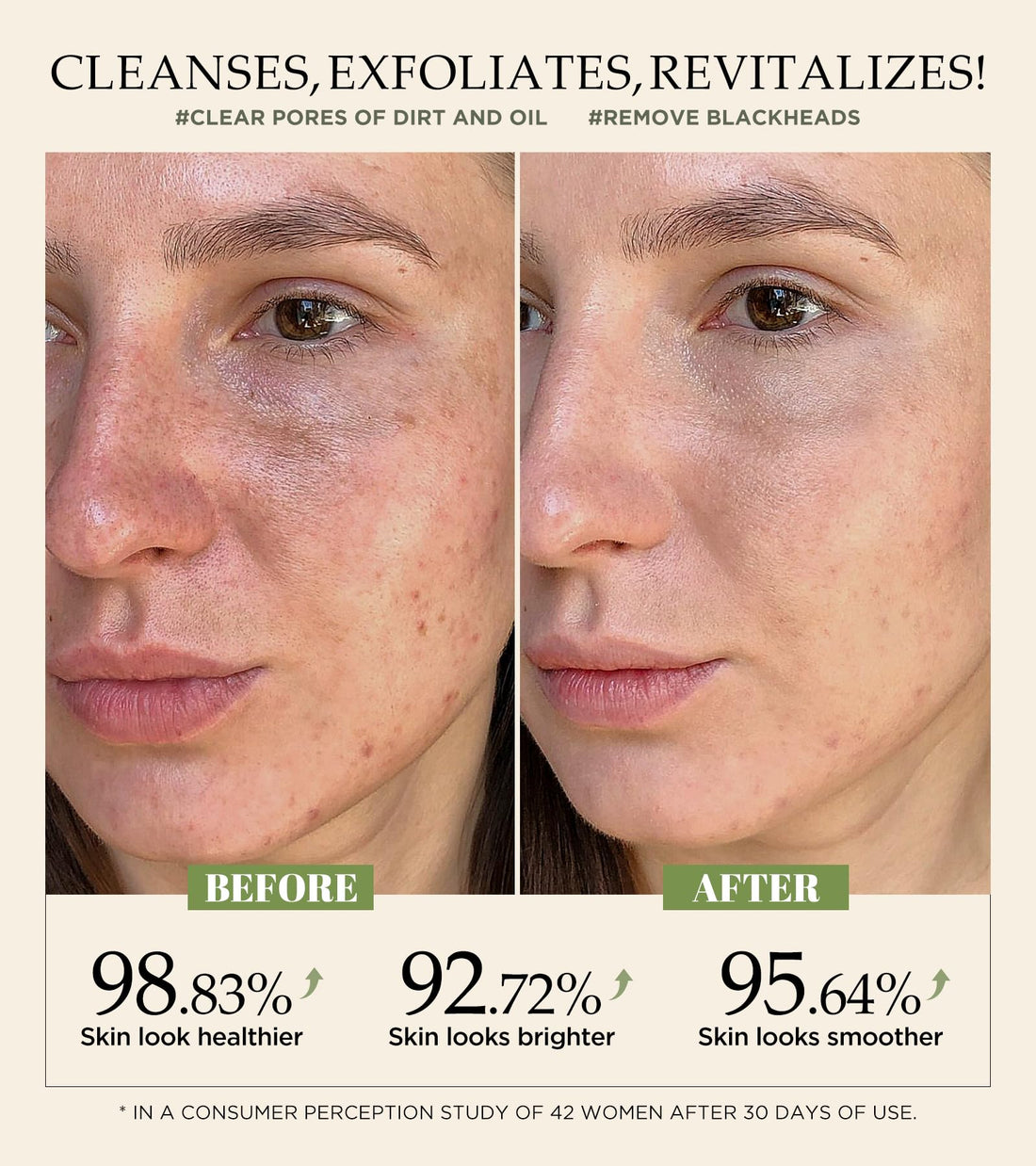 Revitalizing Exfoliation Face Scrub with Vitamin C and Turmeric – Gentle Exfoliating Face Wash for Blackheads, Pore Dirt & Dark Spots – Acne Control Facial Scrub for Oily & Acne-Prone Skin, 4.23 Fl Oz