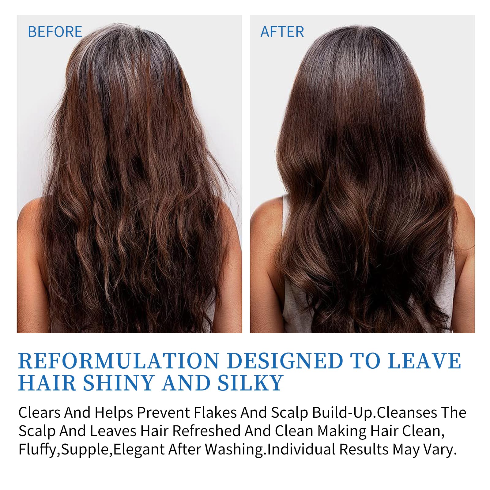 Ceson&Cesun Psoriasis 2 in 1 Shampoo & Conditioner Anti-Dandruff/Anti-Fungal Shampoo for Folliculitis, Effective Scalp Psoriasis Treatment - Relieves Itchy & Dry Scalp