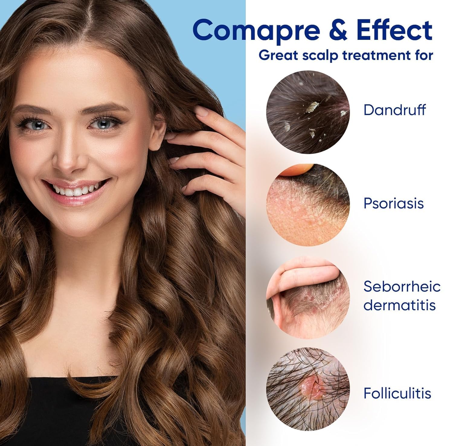 IRISTAR Medicated Shampoo For Seborrheic Dermatitis: Anti-Dandruff Treatment for Itchy Scalp, Dermatitis, Anti-Fungal Care for Men & Women, Controls Oil, Flaking & Scalp Irritation