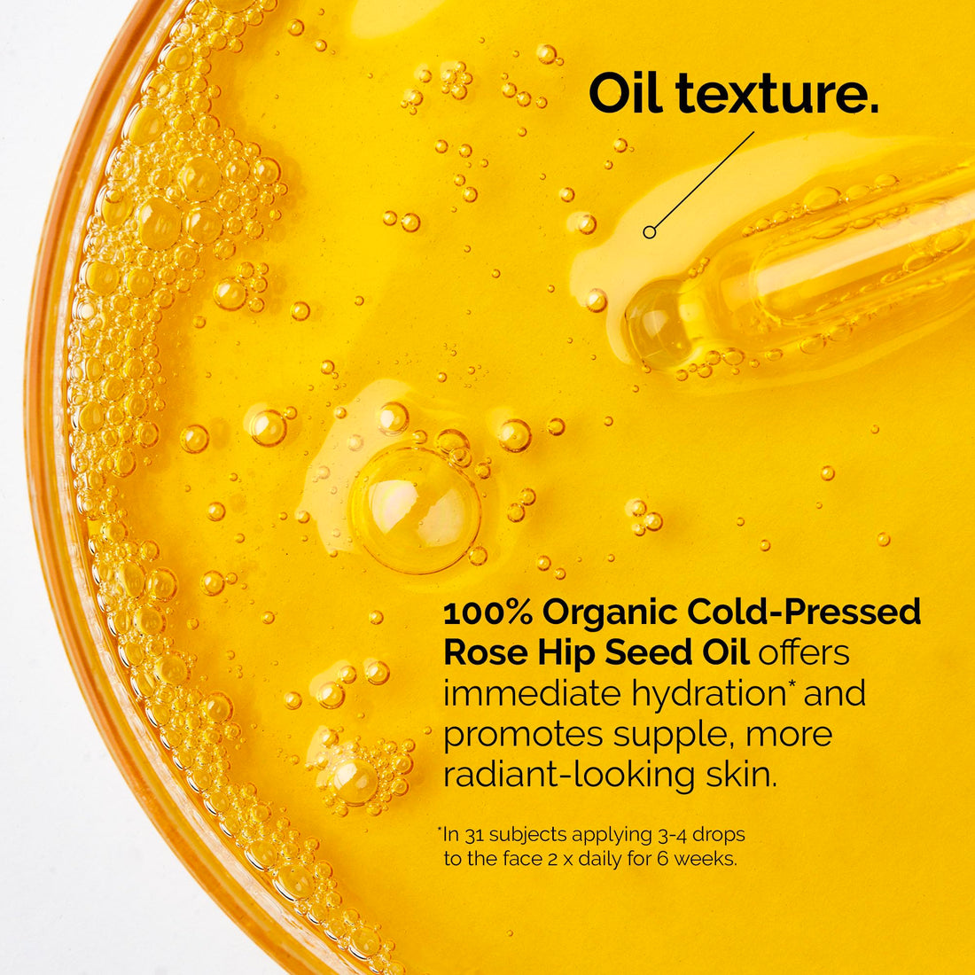 The Ordinary 100% Organic Cold-Pressed Rose Hip Seed Oil, Addresses Signs of Aging by Improving the Appearance of Uneven Skin Tone, Supporting Skin Elasticity, 1 Fl Oz