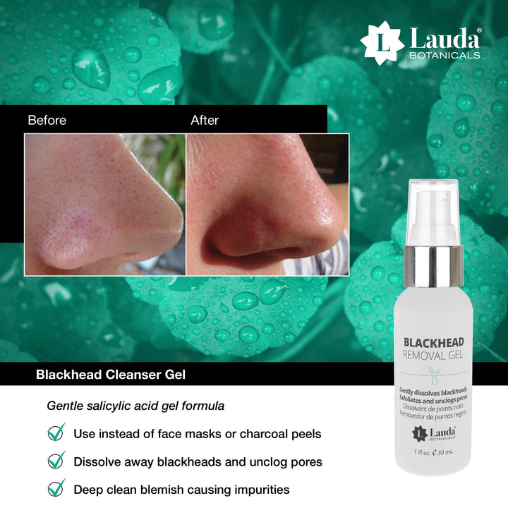 Lauda Blackhead Dissolving Gel - Powerful Exfoliant - Blackhead Remover & Acne Treatment, 30ml