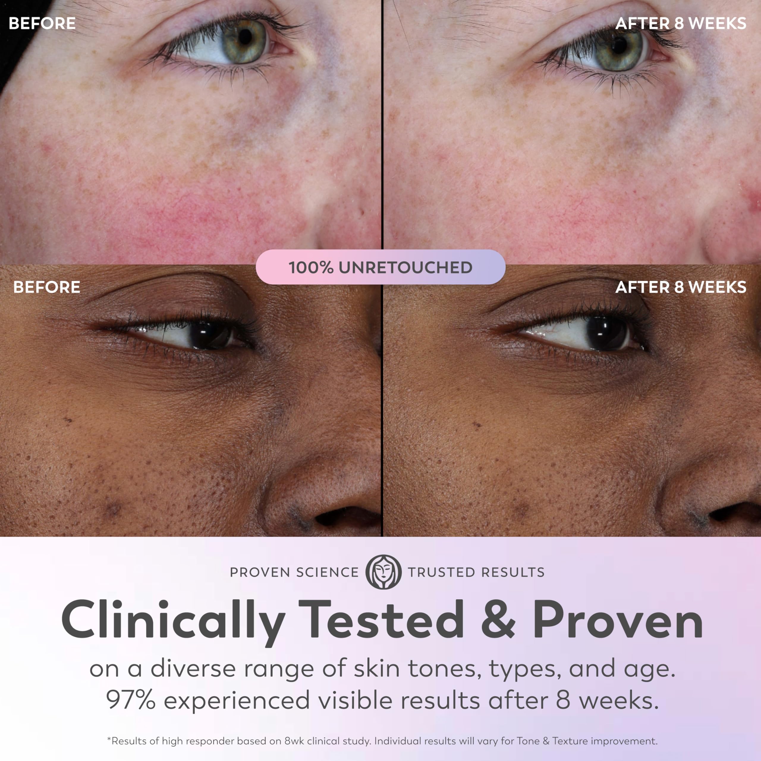 Olay Super Serum Trial Size - Niacinamide, Vitamin C & E, Collagen Peptide, AHA - 5-in-1 Skin Care Benefits - Healthy Glow, Brightening, Hydrating, Smoothing, Firming, Evens Tone, Anti-Aging, 0.4 Oz