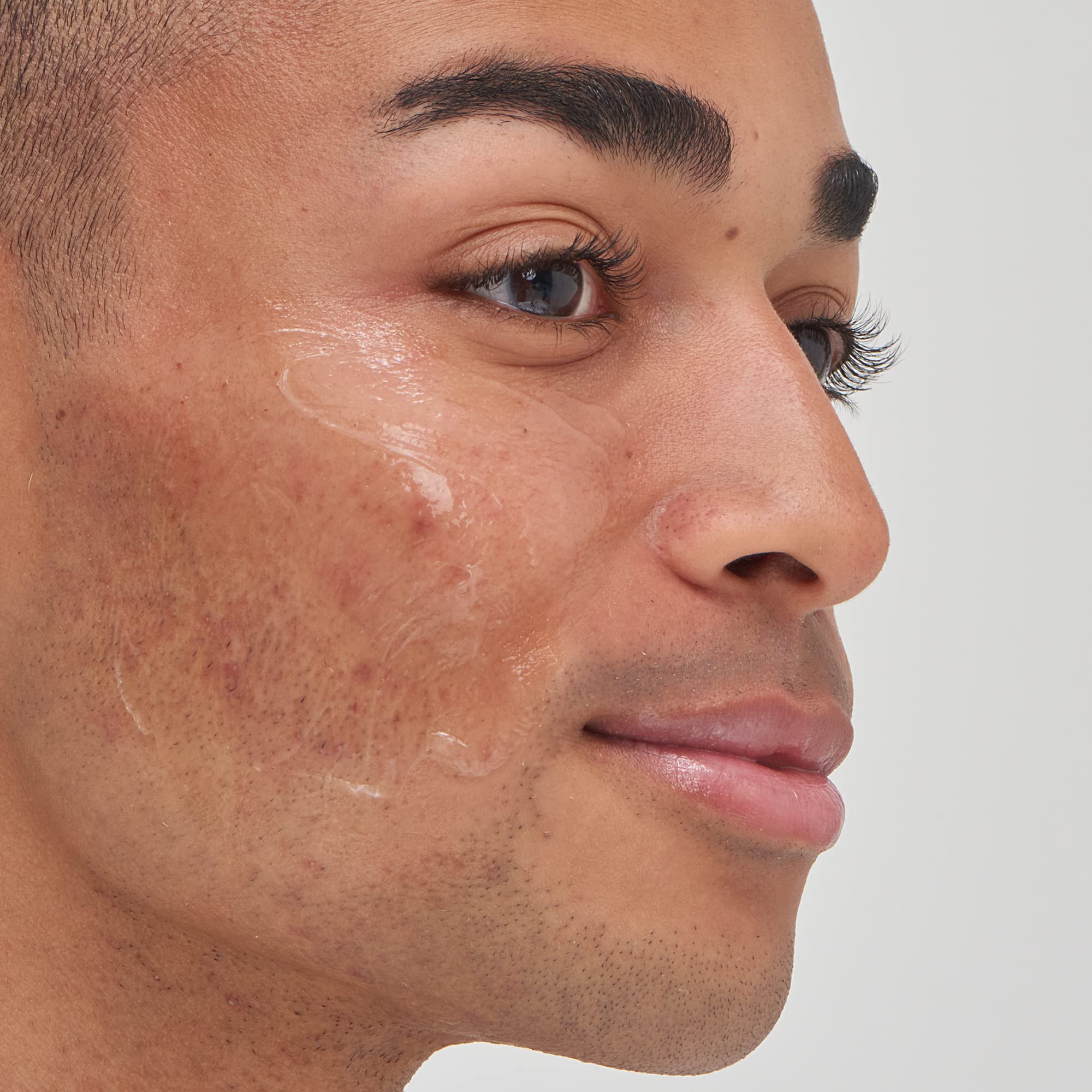 The INKEY List Tranexamic Acid Serum, Helps Reduce Appearance of Skin Discoloration, Dark Spots and Uneven Patches, Healthy-Looking Skin Tone, 1 fl oz