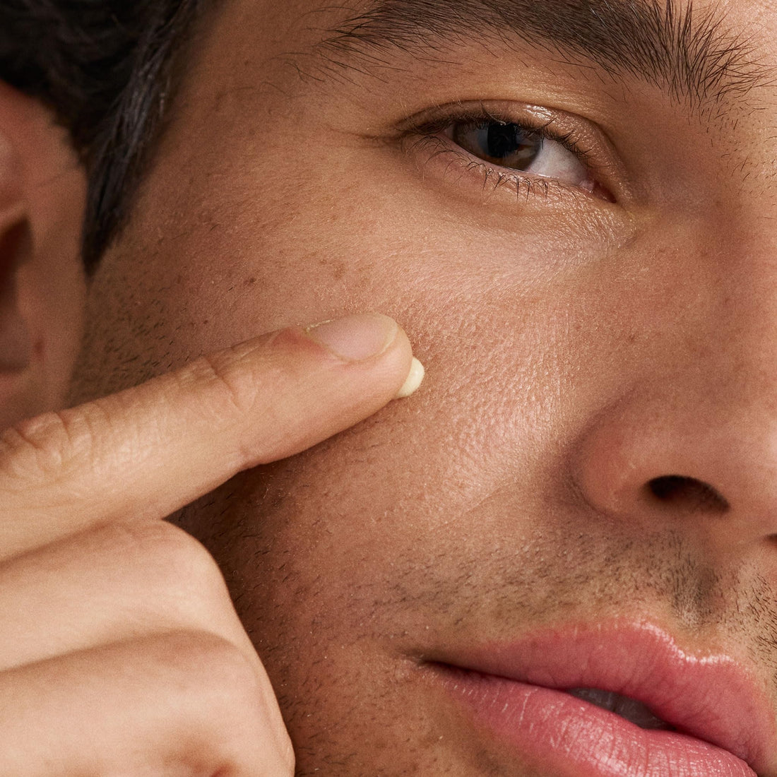 Dermalogica Deep Acne Liquid Patch, Sulfur Acne Treatment with Niacinamide, Invisible Spot Treatment for Blemish-Prone Skin – 0.5 fl oz