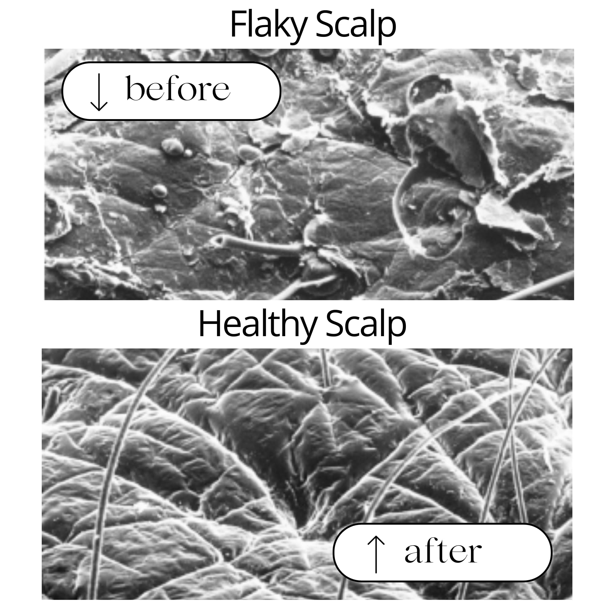 RAUSCH Coltsfoot Anti-Dandruff Shampoo 200 ml