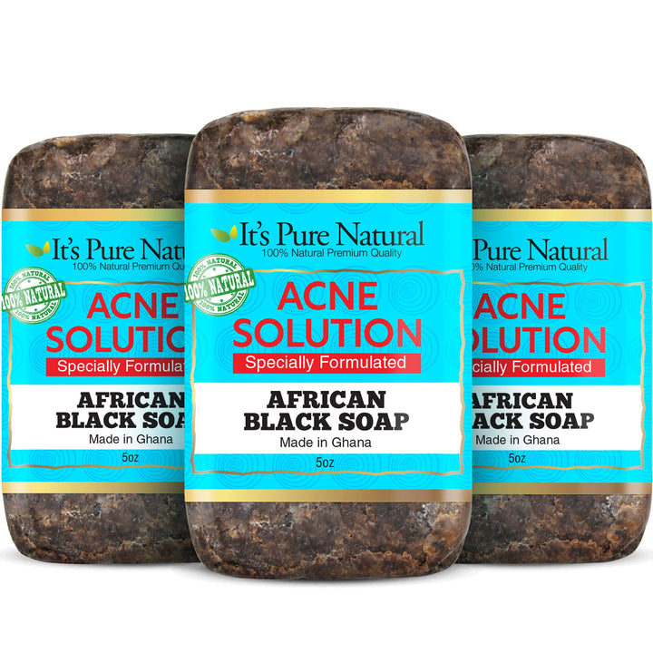 It's Pure Natural African Black Soap Bars with Acne Solution (Pack of 3) Organic Raw Soap for Face & Body, Acne Treatment & Dark Spot Remover [Made in Ghana]