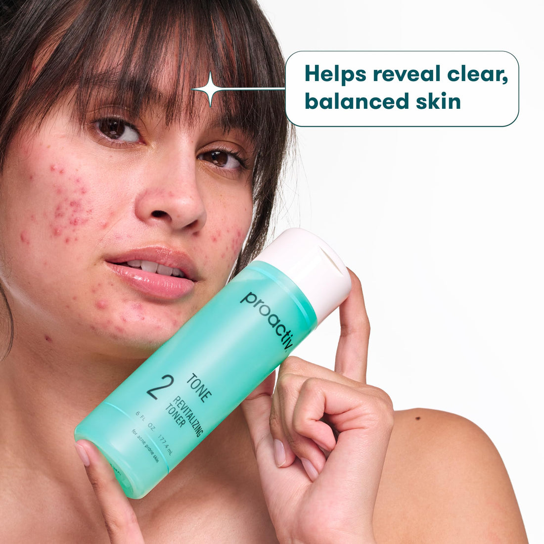 Proactiv Hydrating Facial Toner for Sensitive Skin - Alcohol Free Toner for Face Care - Pore Tightening Glycolic Acid and Witch Hazel Formula - Acne Toner to Balance Skin and Remove Impurities, 4 oz.