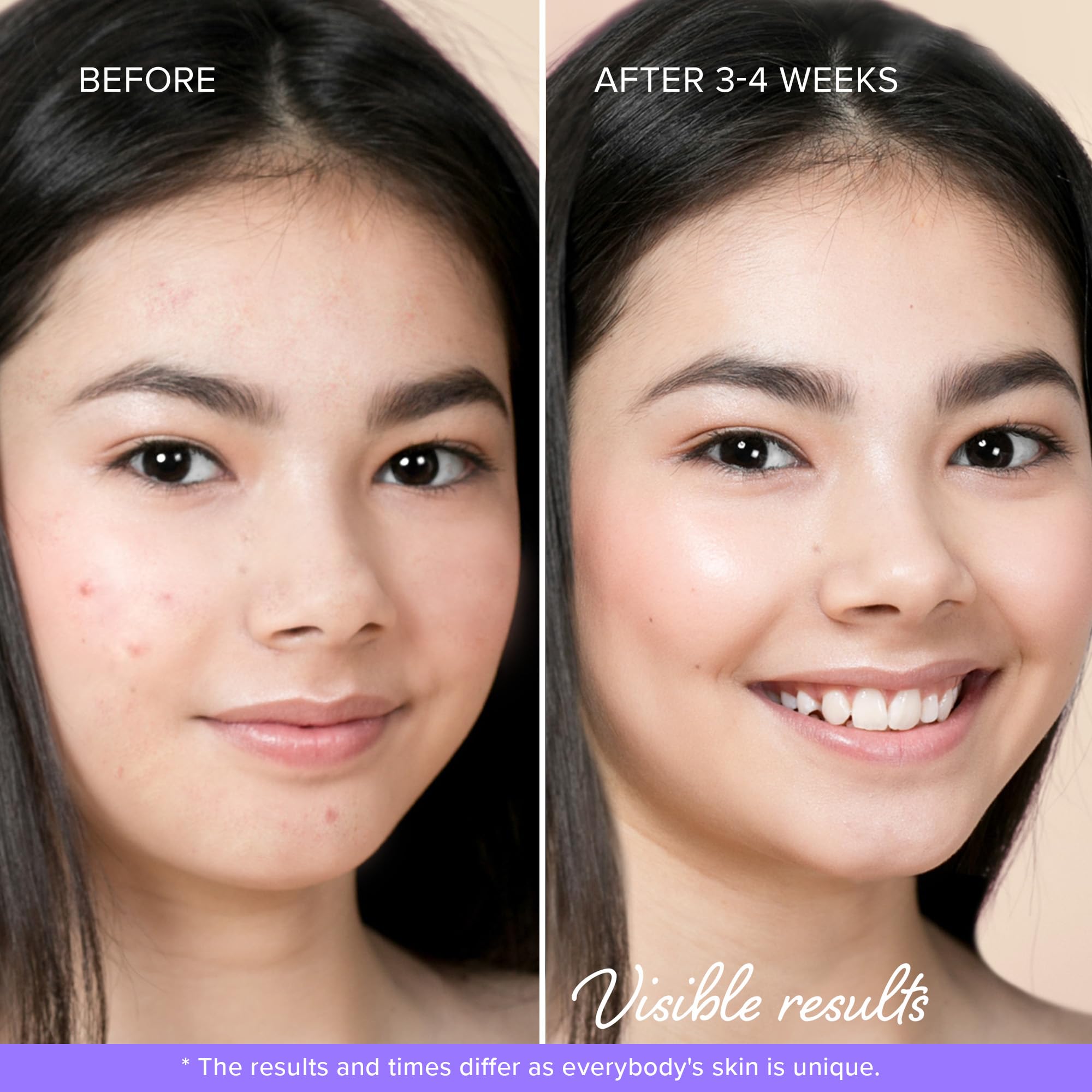 MAREE Star Pimple Patches for Face 2 PACK - Acne Patches - Natural Green Algae Extract & Tea Tree Oil - Hydrocolloid Stars Cute Zit Stickers, Parches Para Acne - Marine Collagen Blemish Pimple