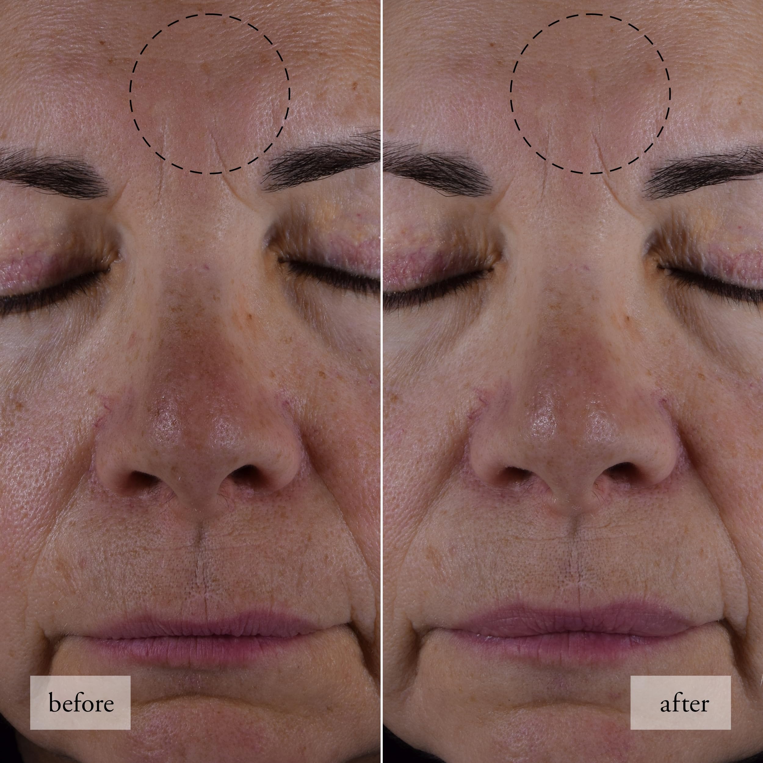 philosophy hope in a jar smooth-glow moisturizer 0.5 fl oz