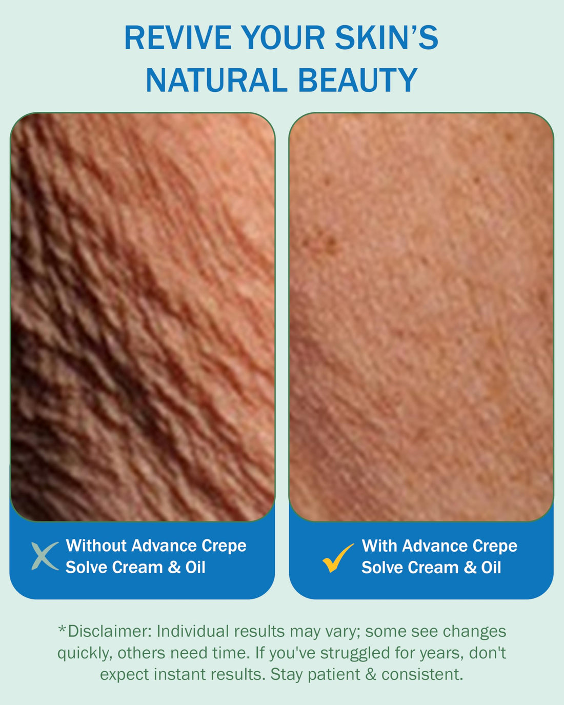 e70 Advance Crepe Solve Hydrating Skin Oil for Women & Men - Made with Natural Oils, Licorice Root & Chamomile Extract - Moisturizing Body Oil for Skin Firmness & Elasticity, 2-Pack