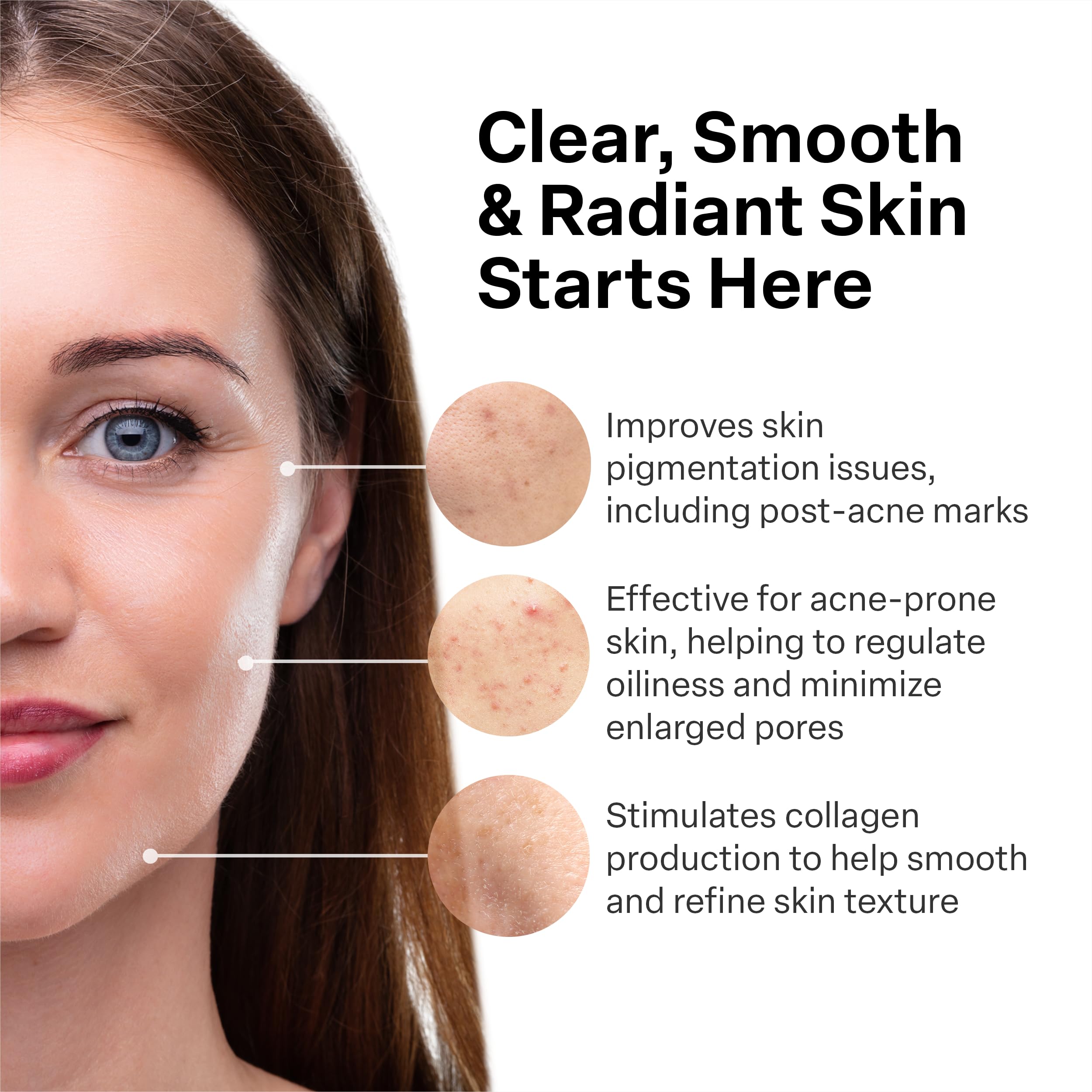 A313 French Pharmacy Vitamin A (Retinoids) Lightweight Face Cream for Anti-Aging, Reduce Wrinkles, Prevents Acne Breakouts, and Hyperpigmentation - Skincare for Smooth, Radiant Skin - 50g Cream