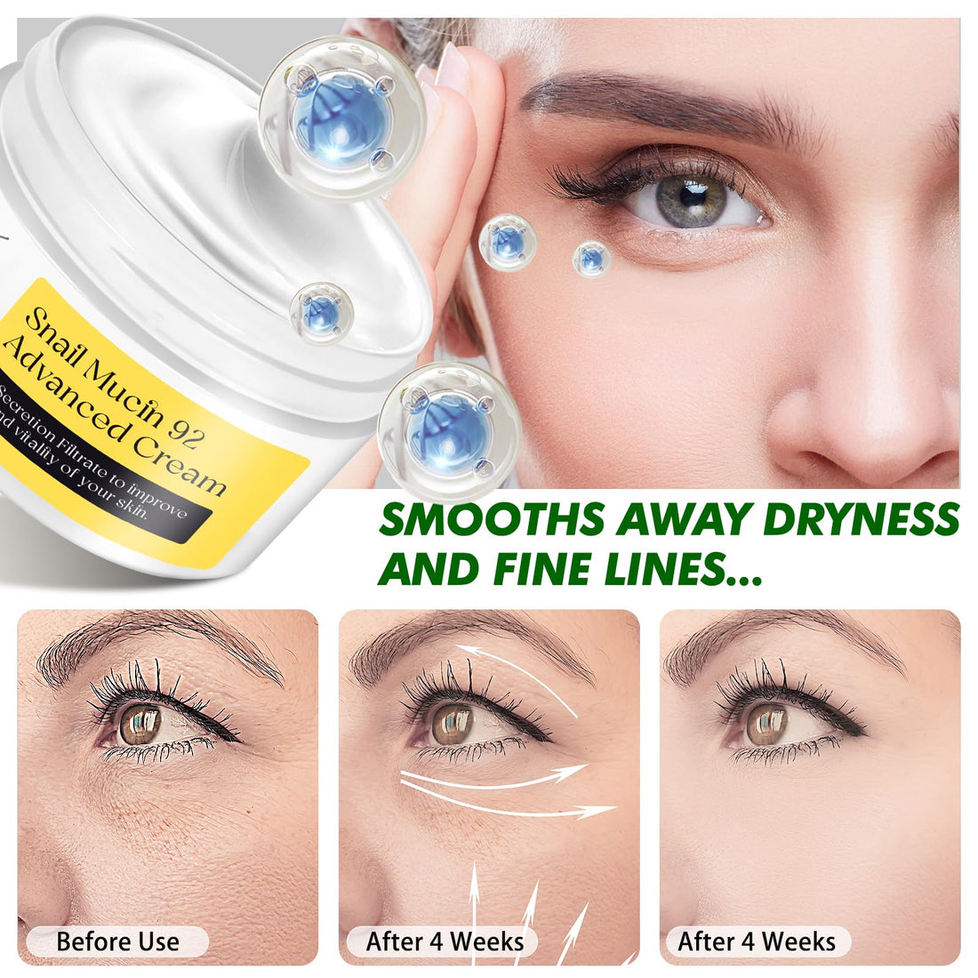 ITSDAWN Snail Mucin 92% Repair Cream 100g, Face Moisturizer Hydrating Repair Face Cream for Dry & Sensitive Skin, All Skin Types