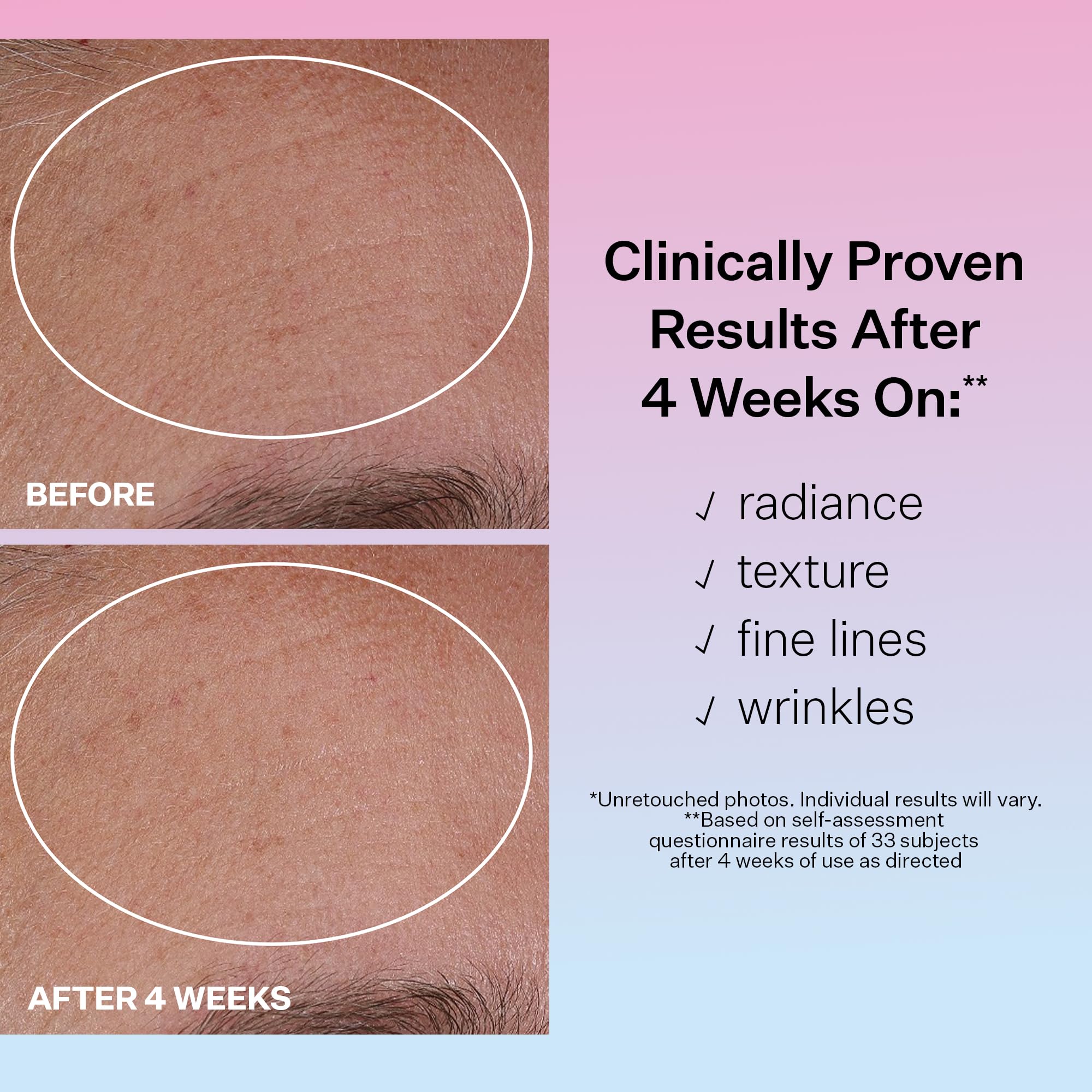 StriVectin Multi Action Hydration Multiplier Serum with Hyaluronic Acid, Ceramides and Peptides for Dehydrated, Dry Skin