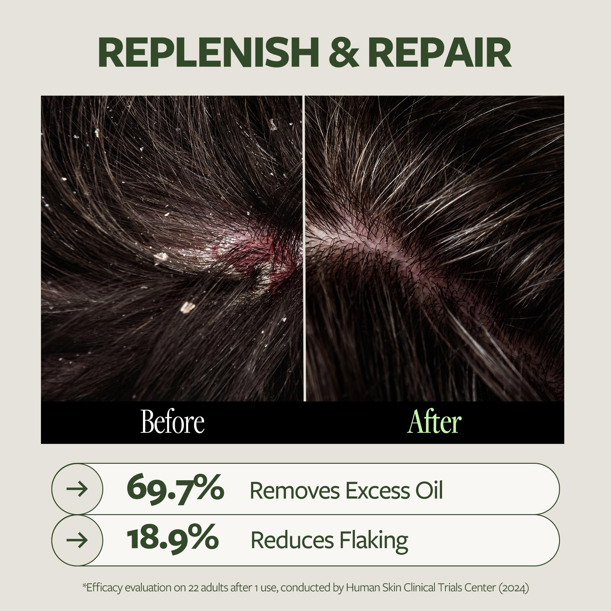 LAPCOS DR.14 REVITALIZING SCALP CARE SHAMPOO