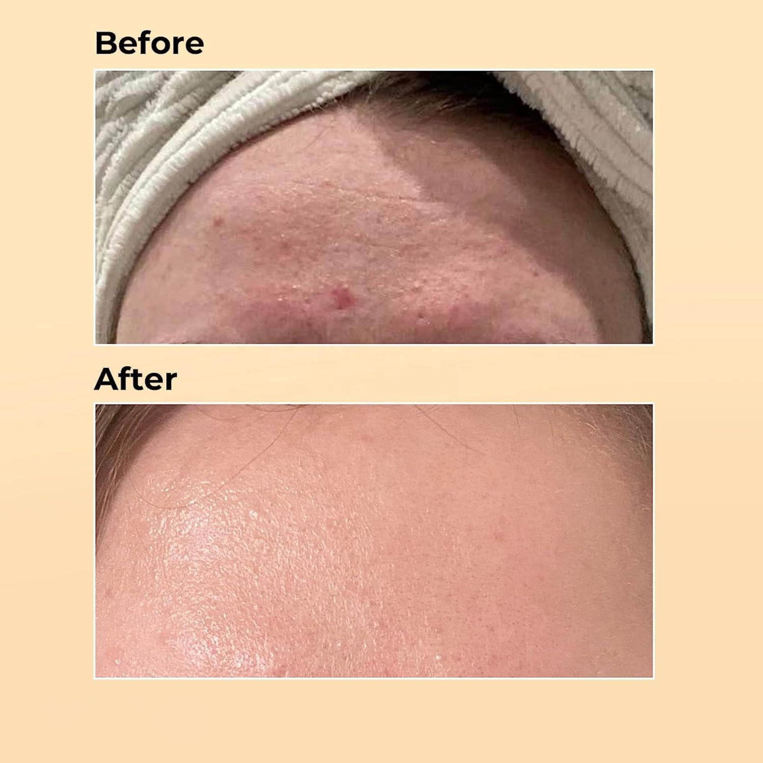 Snail Mucin Serum Luxury Korean 96% Snail Facial Serum Filtrate for skincare, Hydrating Serum For Dry Dull Face Skin and Wrinkles Power Repairing Essence For Face - GoldSnailRX