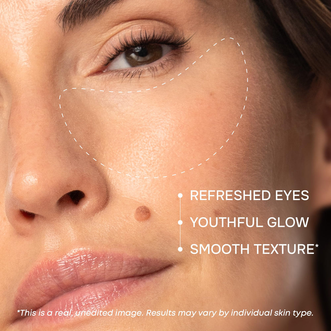 Under Eye Patches for Puffy Eyes and Dark Circles - Cooling Eye Masks for Women & Men with Collagen, Hyaluronic Acid & Retinol - Depuffing Undereye Mask Patches - Parches Para Ojeras - 15 Pairs