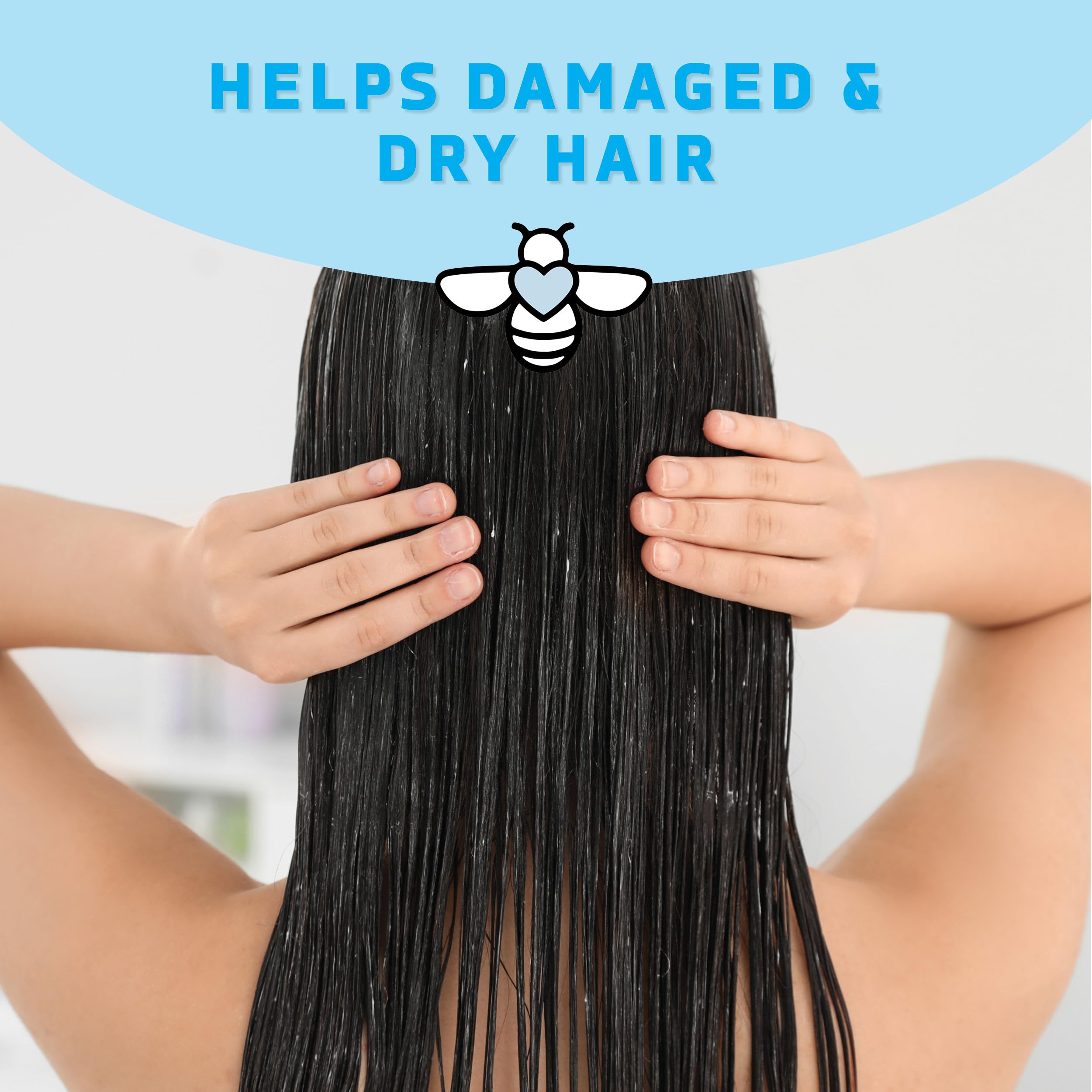 PSORIASIS HONEY Renewing Conditioner - Dry Scalp Treatment - Psoriasis Cream for Dry Hair - Coconut Oil Hair Moisturizer Helps Relieve Symptoms of Eczema, Dandruff, Dermatitis & More (8oz)