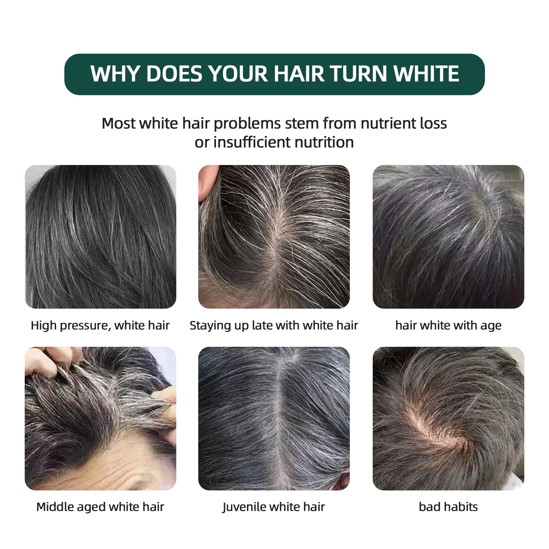 VAEYAE Natural Usman Grass Shampoo Bar, Cover Grey Hair Thickening & Darkening Usma Bar, Ultimate Solution for Healthy Hair Growth, Gray Hair Reverse Black Soap, Reducing Thinning Hair Loss 2 Pcs