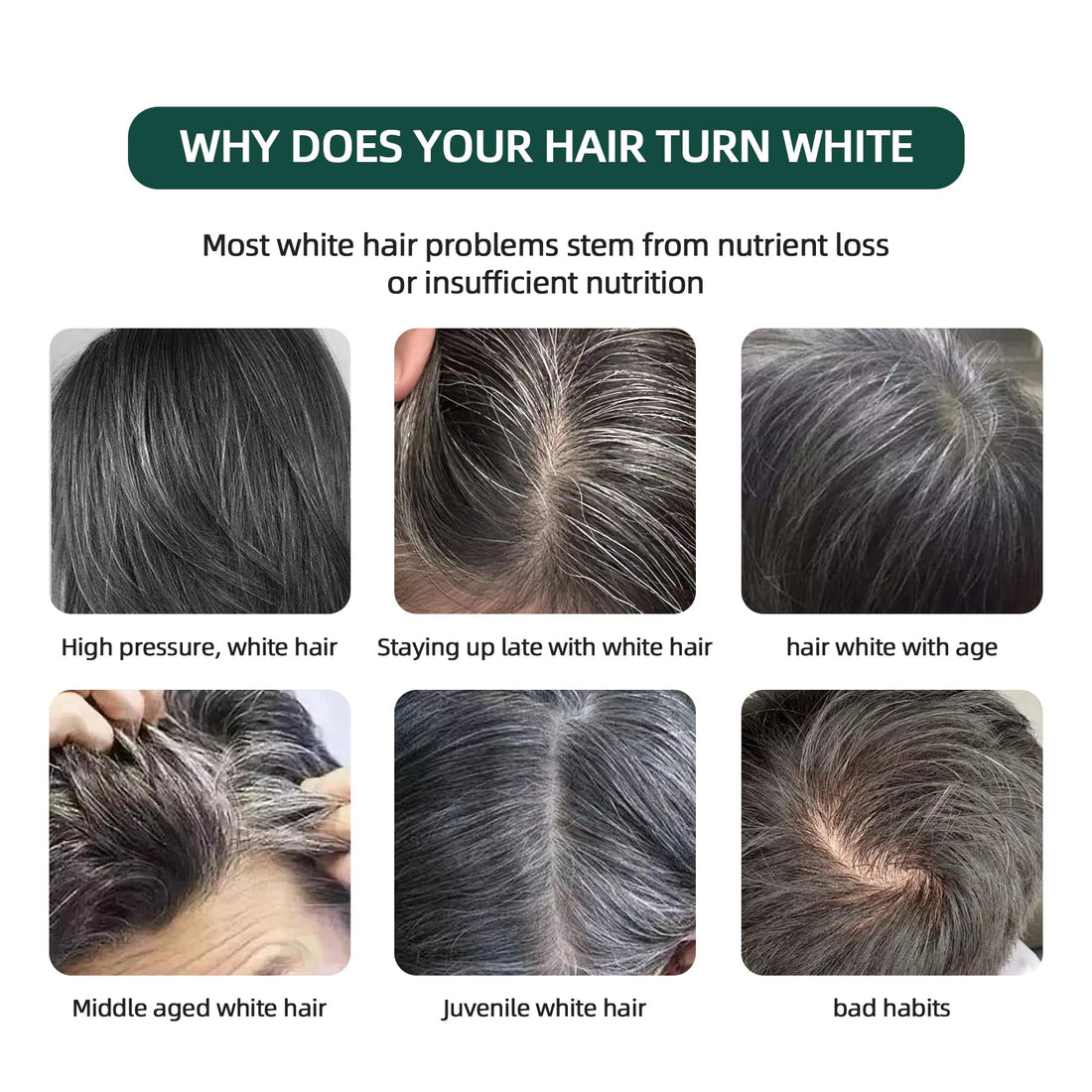 VAEYAE Natural Usman Grass Shampoo Bar, Cover Grey Hair Thickening & Darkening Usma Bar, Ultimate Solution for Healthy Hair Growth, Gray Hair Reverse Black Soap, Reducing Thinning Hair Loss 2 Pcs