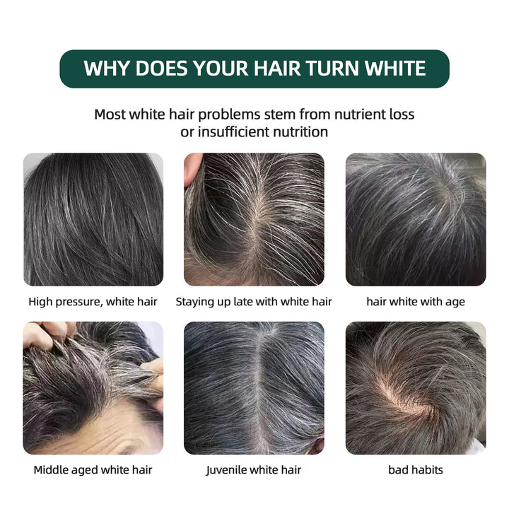 VAEYAE Natural Usman Grass Shampoo Bar, Cover Grey Hair Thickening & Darkening Usma Bar, Ultimate Solution for Healthy Hair Growth, Gray Hair Reverse Black Soap, Reducing Thinning Hair Loss 2 Pcs