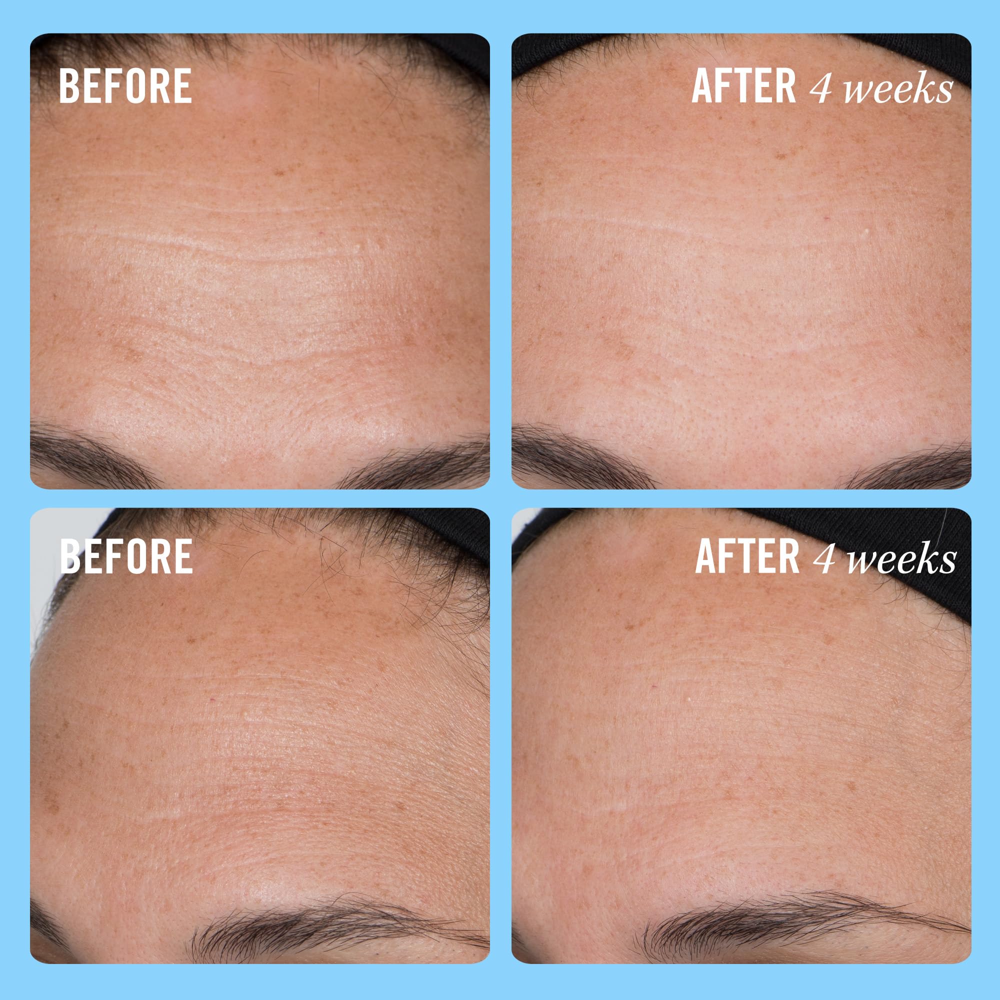 First Aid Beauty Firming Collagen Cream with Collagen, Peptides and Niacinamide – Day + Night Anti-Aging Face Moisturizer – 1.7 fl oz