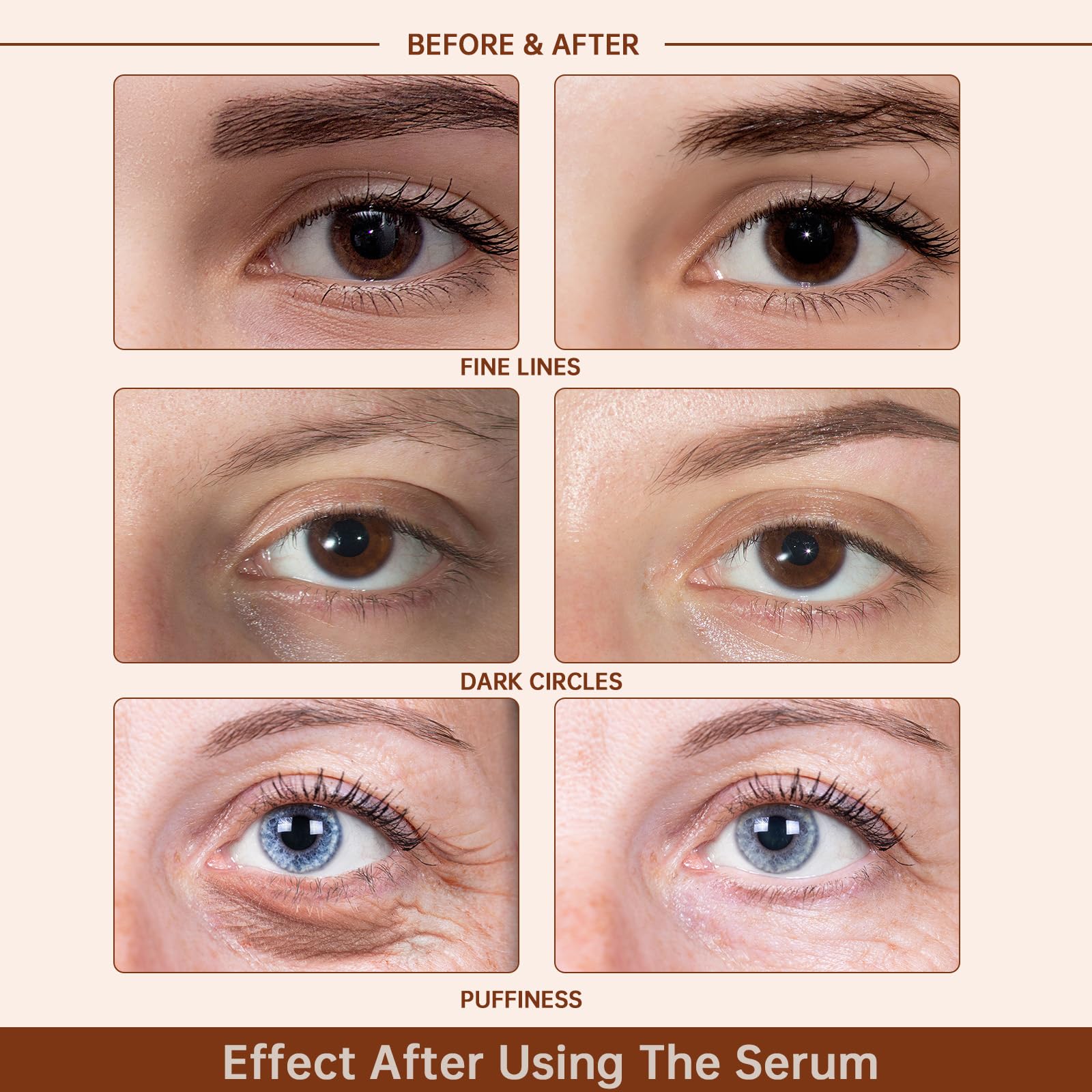 Caffeine Solution 5% + EGCG Eye Serum for Skin Care Caffeine Eye Serum Hyaluronic Acid Serum Reducing Puffiness and Dark Circles, Niacinamide Serum Under Eye Serum, Under Eye Bags and Wrinkles 30ml