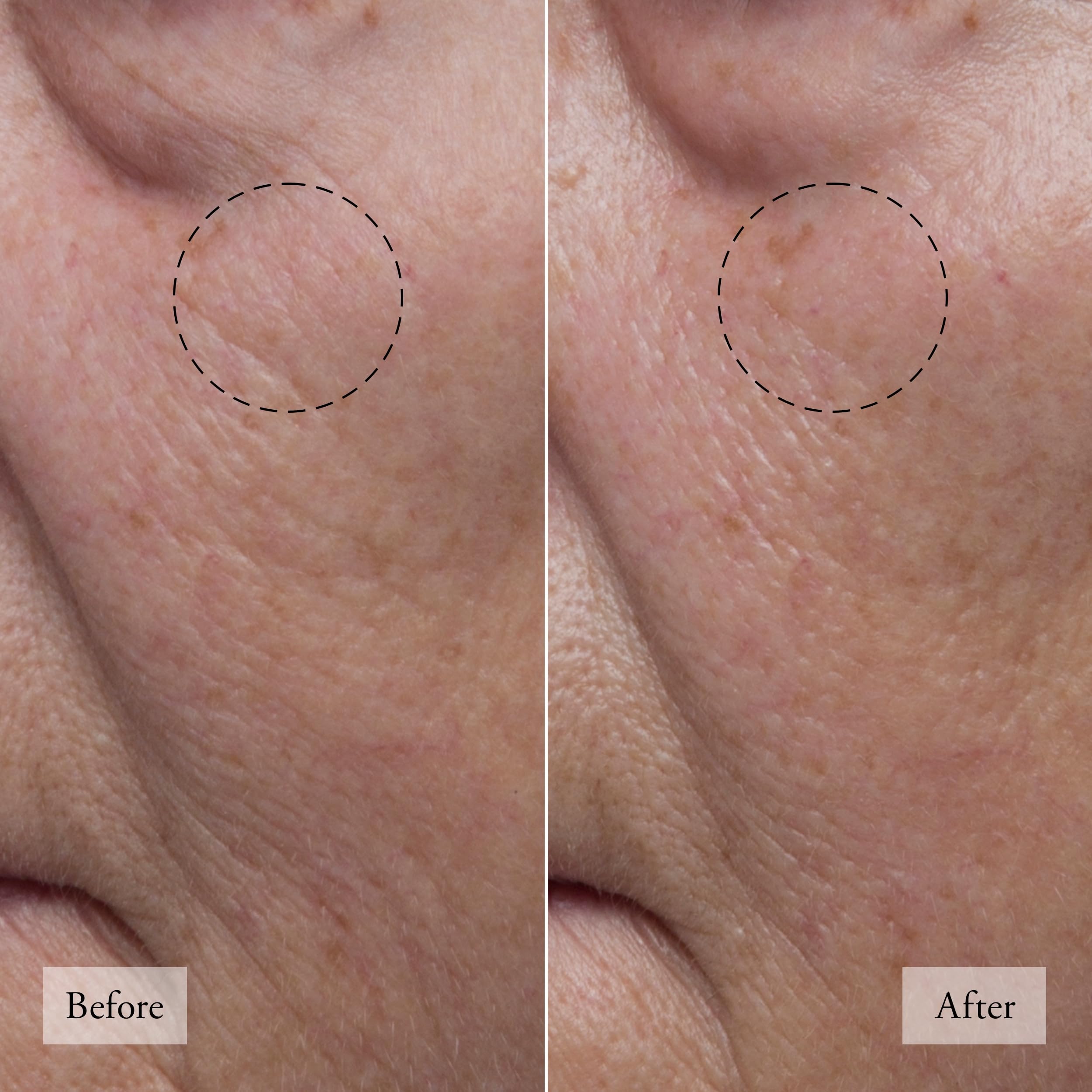 philosophy hope in a jar glow water cream face moisturizer - with hyaluronic acid & pineapple extract provides 72-hour hydration & primes skin for makeup 2 fl oz