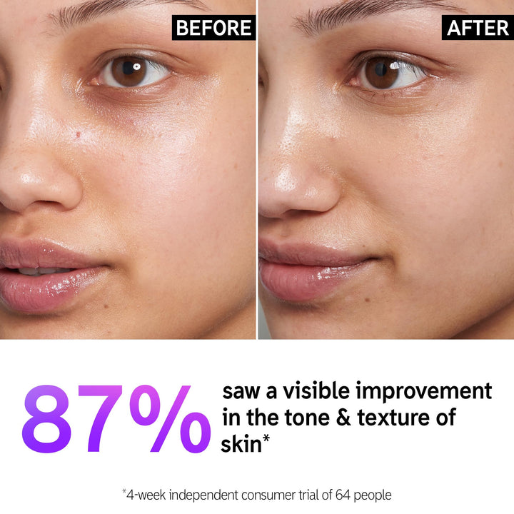 The INKEY List 15% Vitamin C and EGF Serum Helps to Intensively Brighten All Skin Types 30ml