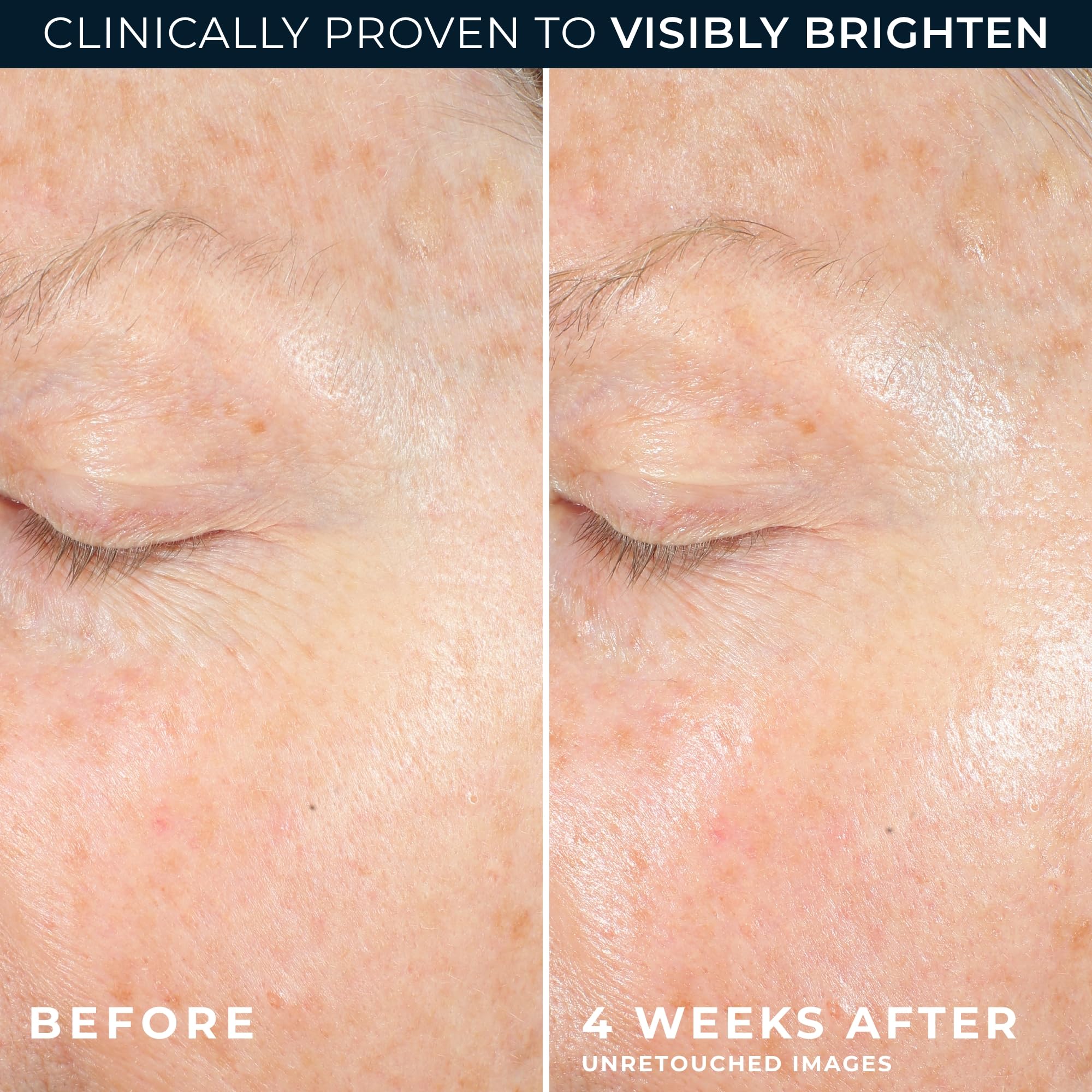 RoC Multi Correxion Revive + Glow 10% Vitamin C Blend Face Moisturizer, Anti-Aging Gel Cream for Instant Glow, Hypo-Allegenic & Oil-Free Skin Care, 1.7 Ounces (Packaging May Vary)