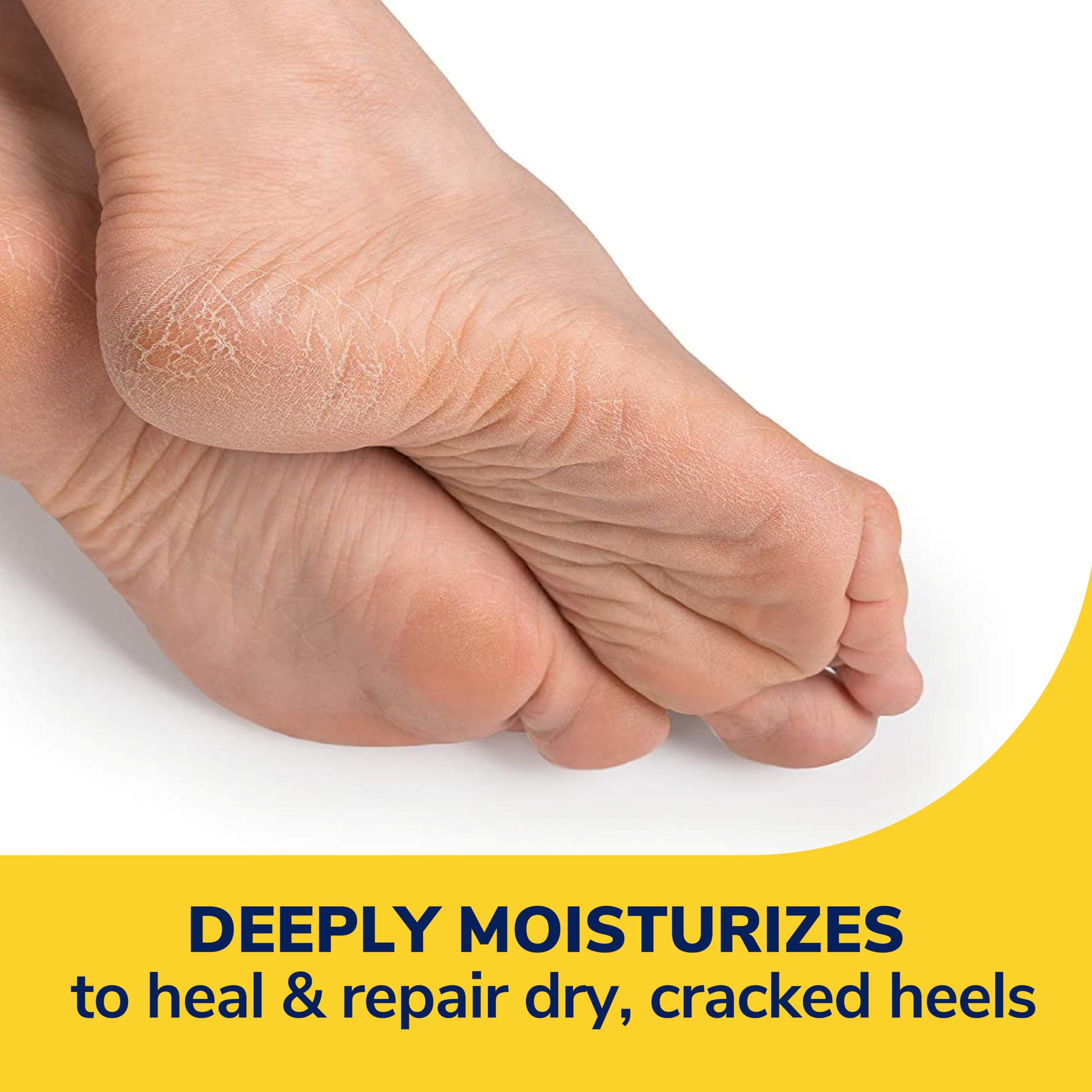 Dr. Scholl's Severe Cracked Heel Repair Restoring Balm 2.5oz, with 25% Urea for Dry, Cracked Feet, Heals and Moisturizes for Healthy Feet, Epsom Salt Soothes, Safe for Diabetics, 3-pack