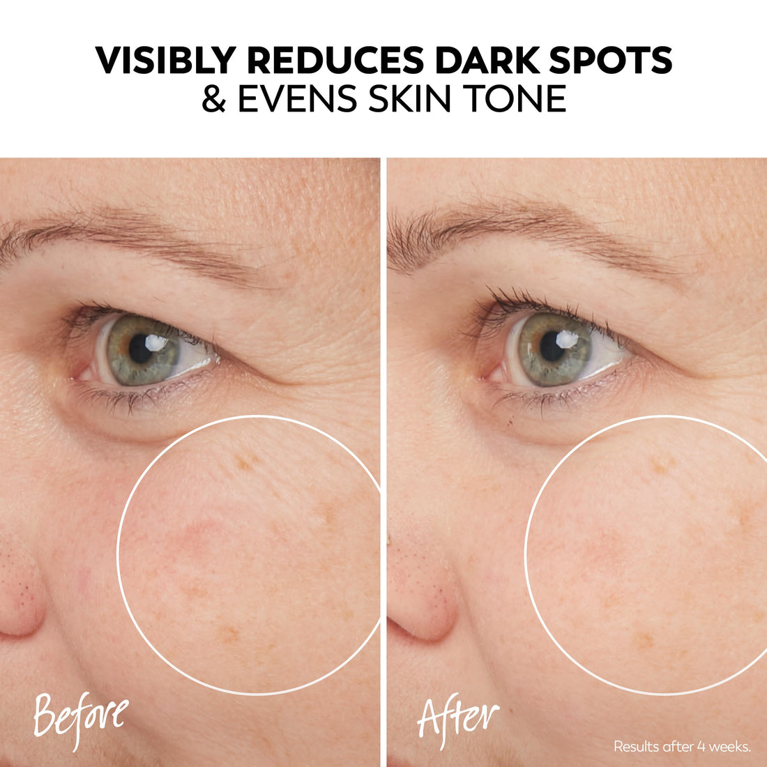 Olay Pro-X Dermatological Even Skin Tone Spot Fading Treatment Serum, 1.3 oz