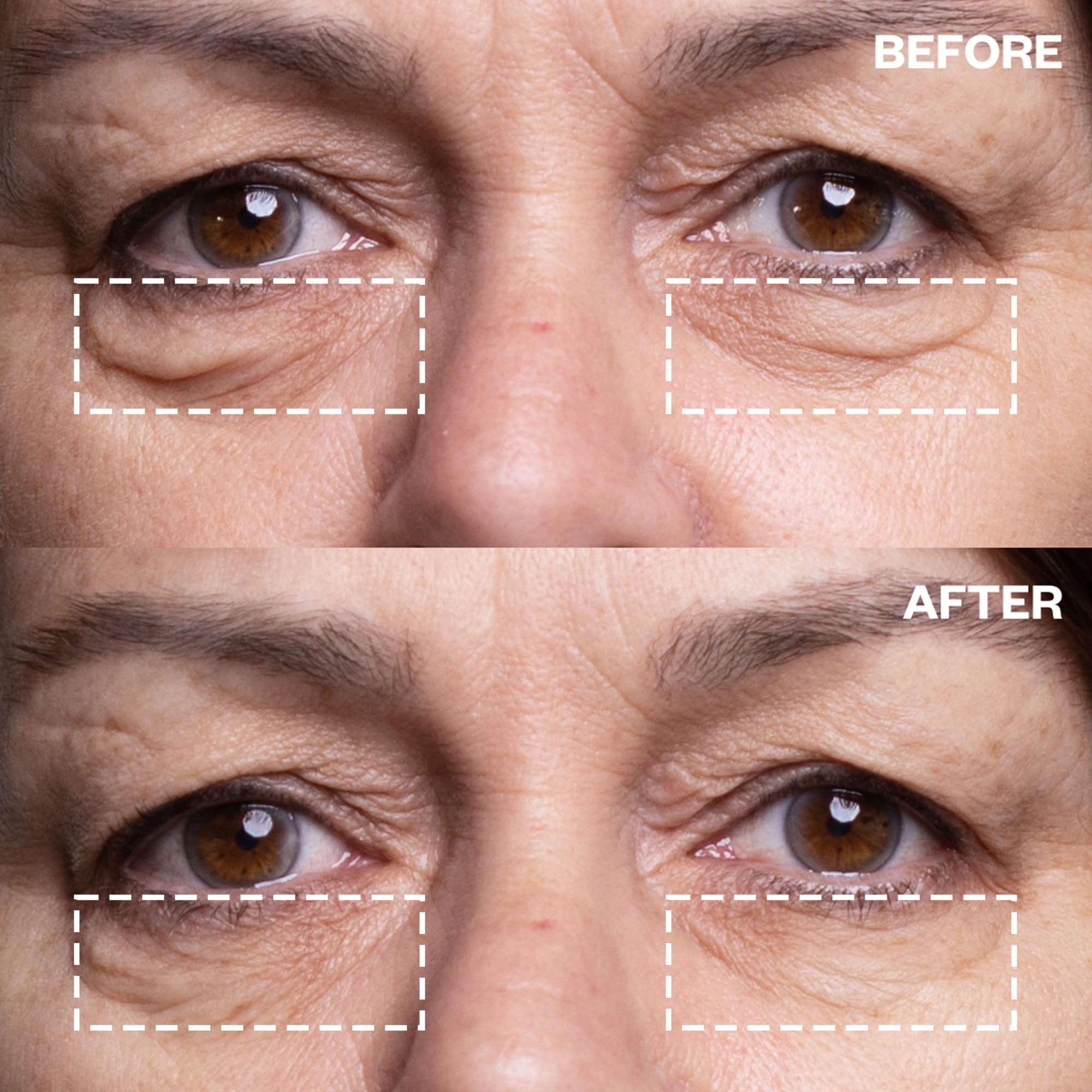 Wrinkles Schminkles Eye Smoothing Kit