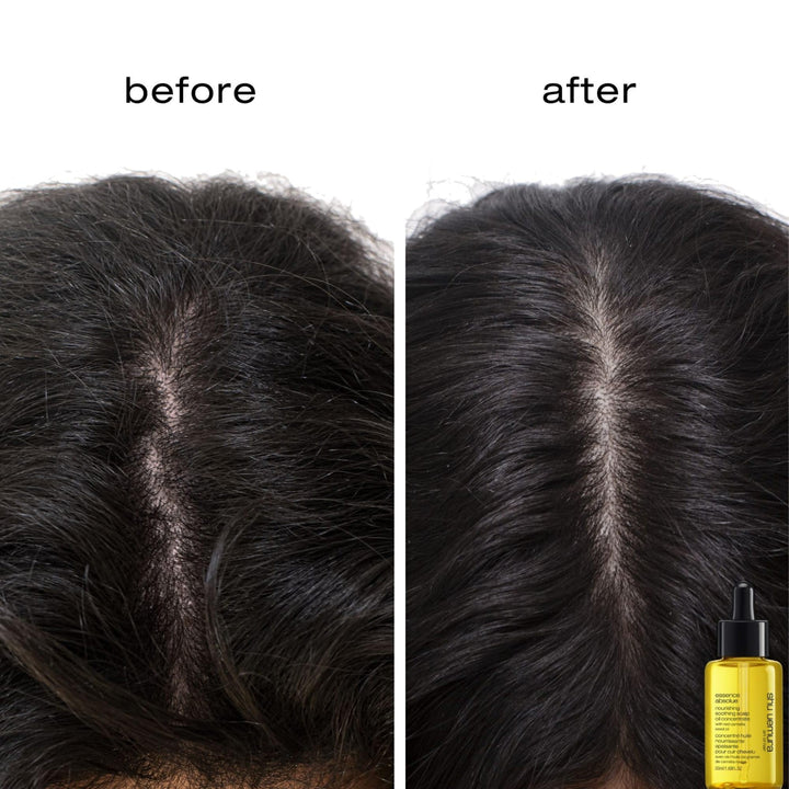 Shu Uemura Essence Absolue Pre-Shampoo & Nourishing Treatment Oil - Soothes Dry and Flaky Scalp, Leaves Scalp Moisturized and Balanced, Nourishes For Soft and Shiny Hair