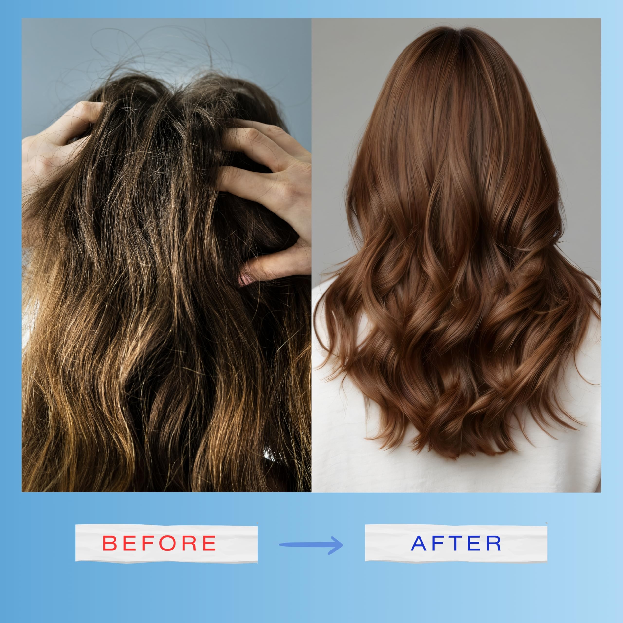 Mediceuticals X-Derma Dry Scalp & Hair Treatment Shampoo -Size: 8.45 oz/250 ml