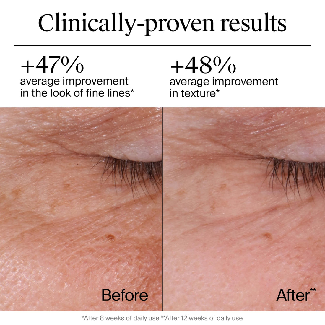 Neutrogena Rapid Wrinkle Repair Retinol Face Moisturizer, Fragrance Free, Anti-Aging Face Cream with Retinol & Hyaluronic Acid, 1.7 oz + Trial Size Hydro Boost Facial Cleanser, 0.5 fl. oz