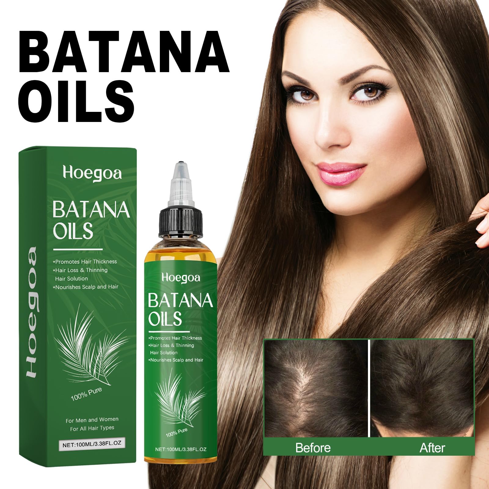 Hoegoa Batana Oil for Hair Growth - 100% Pure & Natural for Thicker, Stronger Hair Nourishes Protects Hair with Palm oil - 3.38 FL OZ (2PCS)
